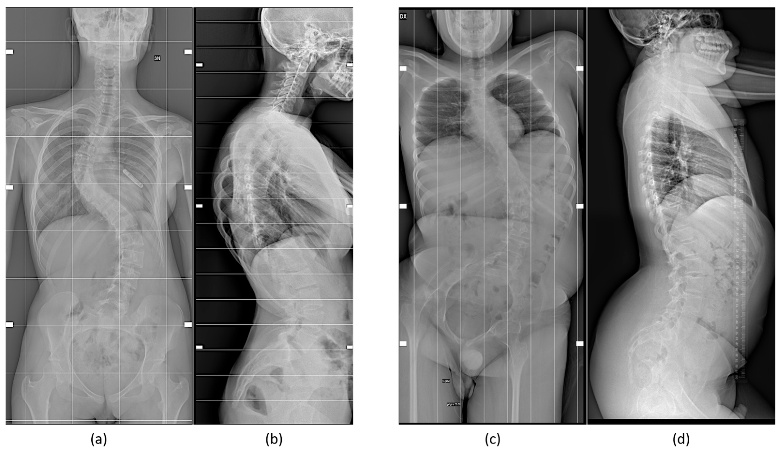 Biomedicines 12 00974 g001