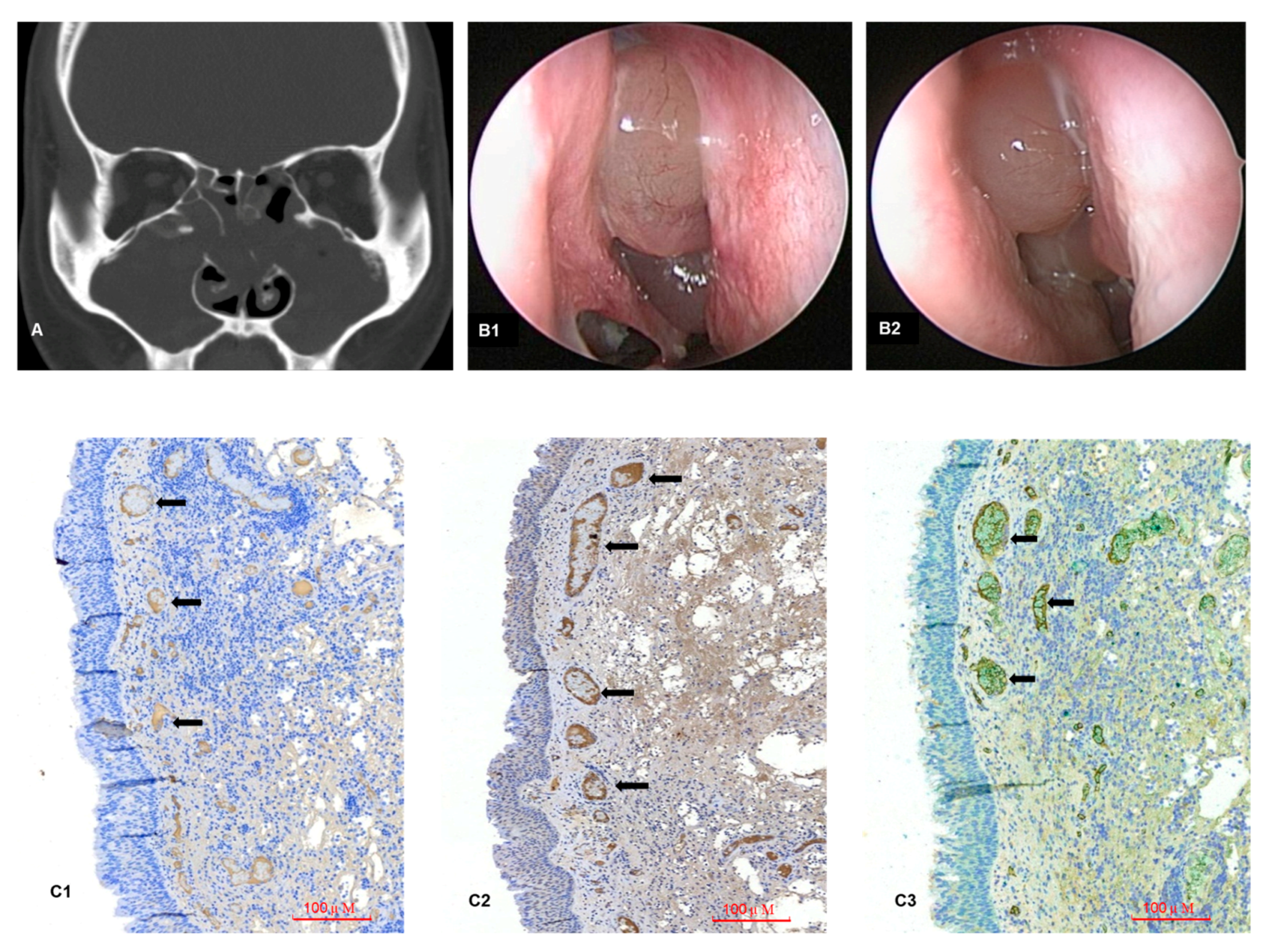 Biomedicines 12 00980 g005 Biomedicines 12 00980 g005