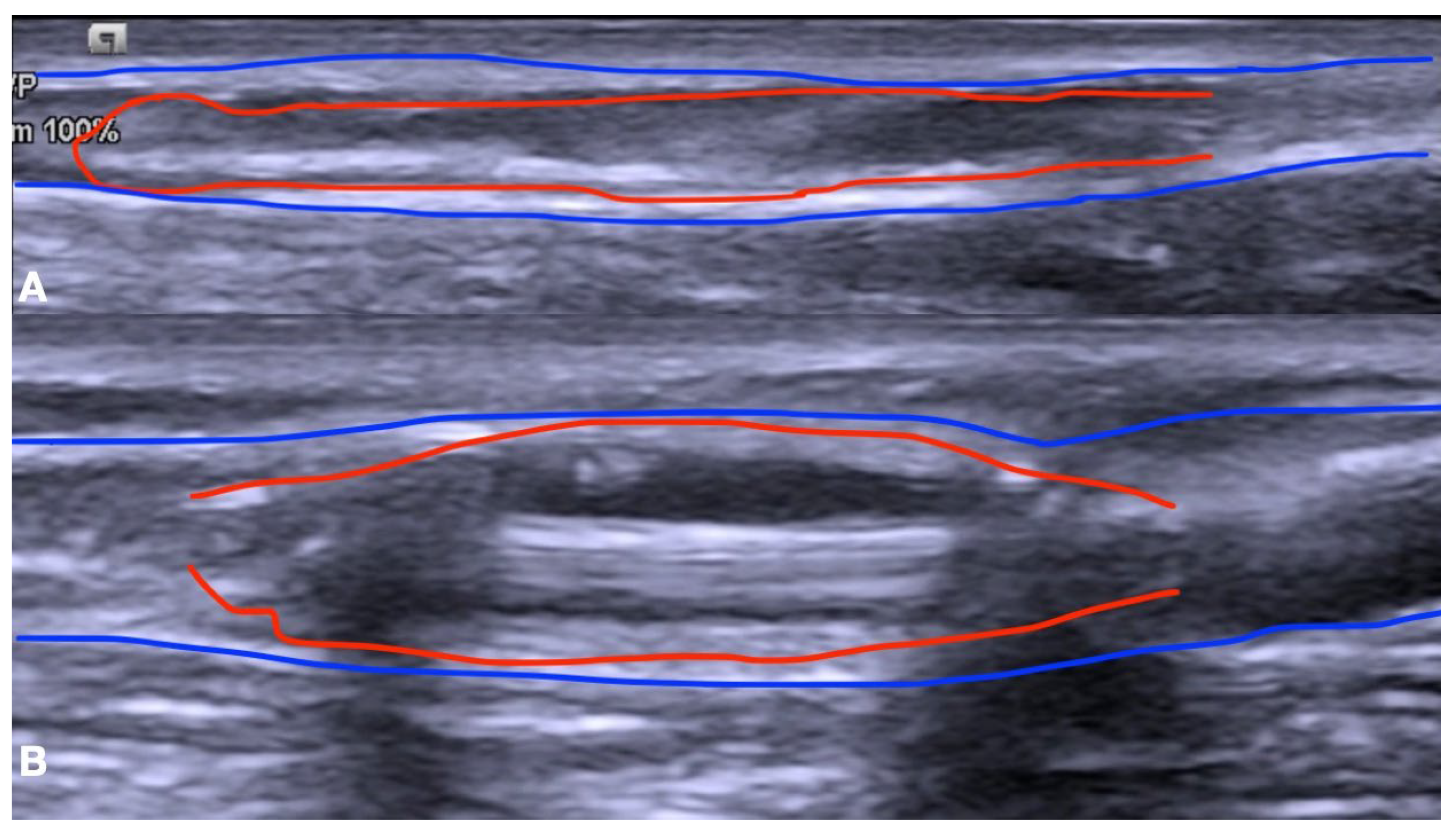 Biomedicines 12 01005 g004