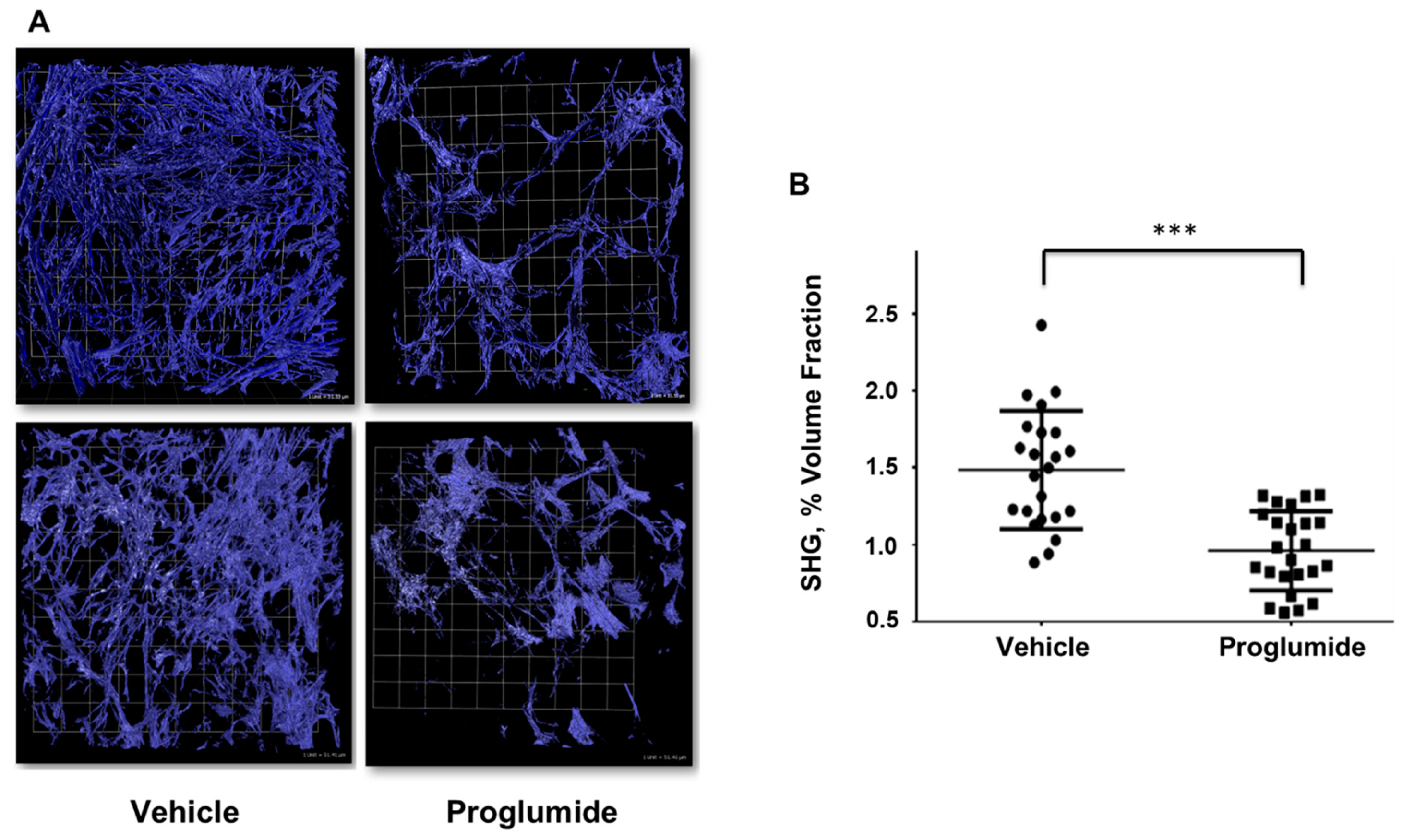 CCK Receptor Inhibition Reduces Pancreatic Tumor Fibrosis CCK Receptor Inhibition Reduces Pancreatic Tumor Fibrosis