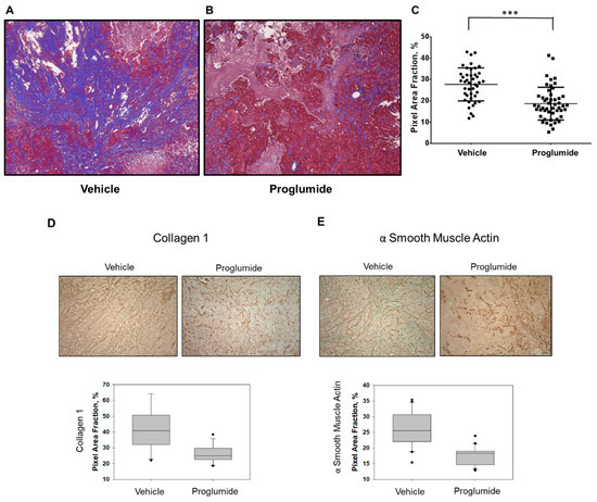 CCK Receptor Inhibition Reduces Pancreatic Tumor Fibrosis