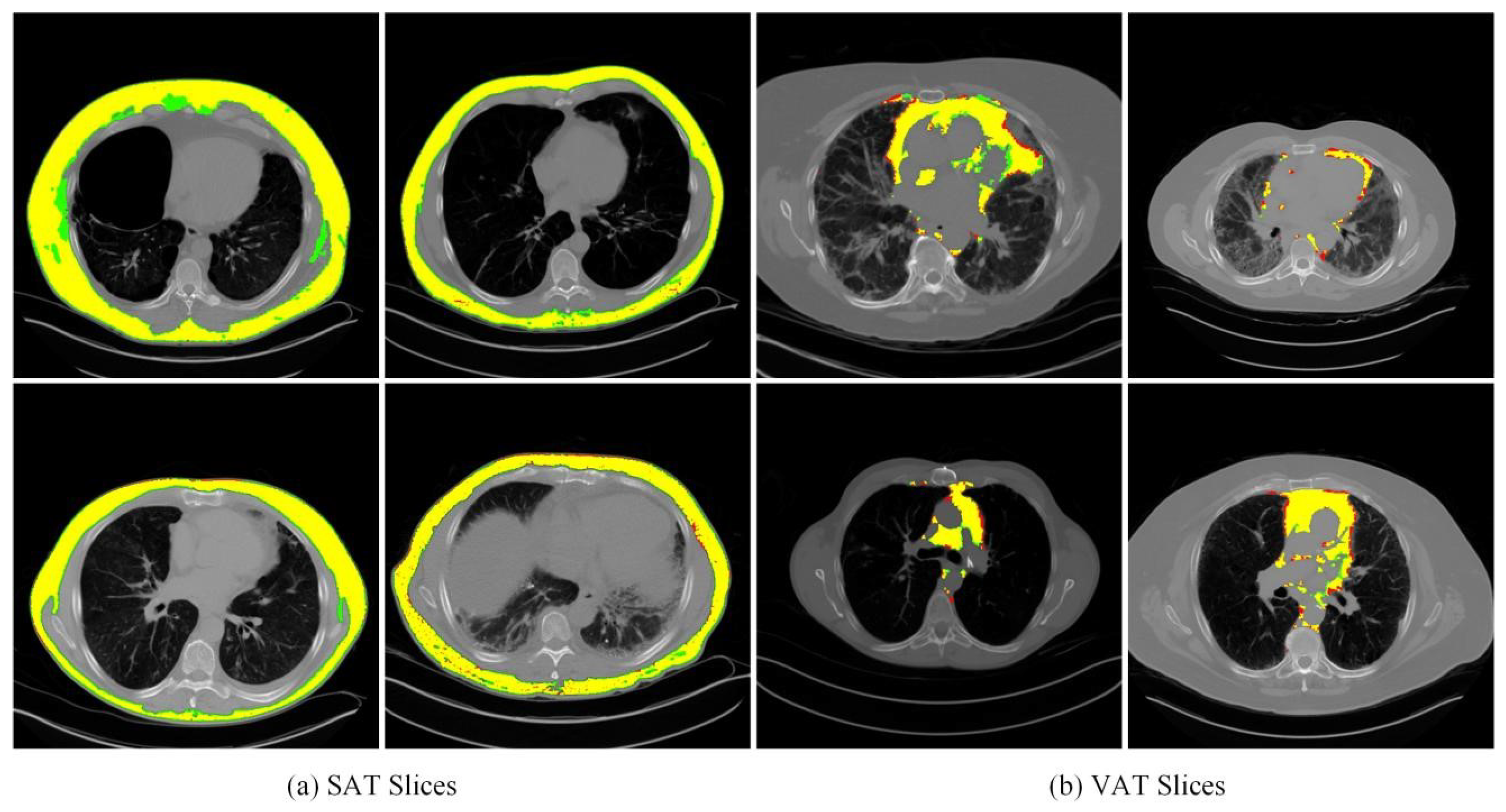 Biomedicines 12 01061 g008
