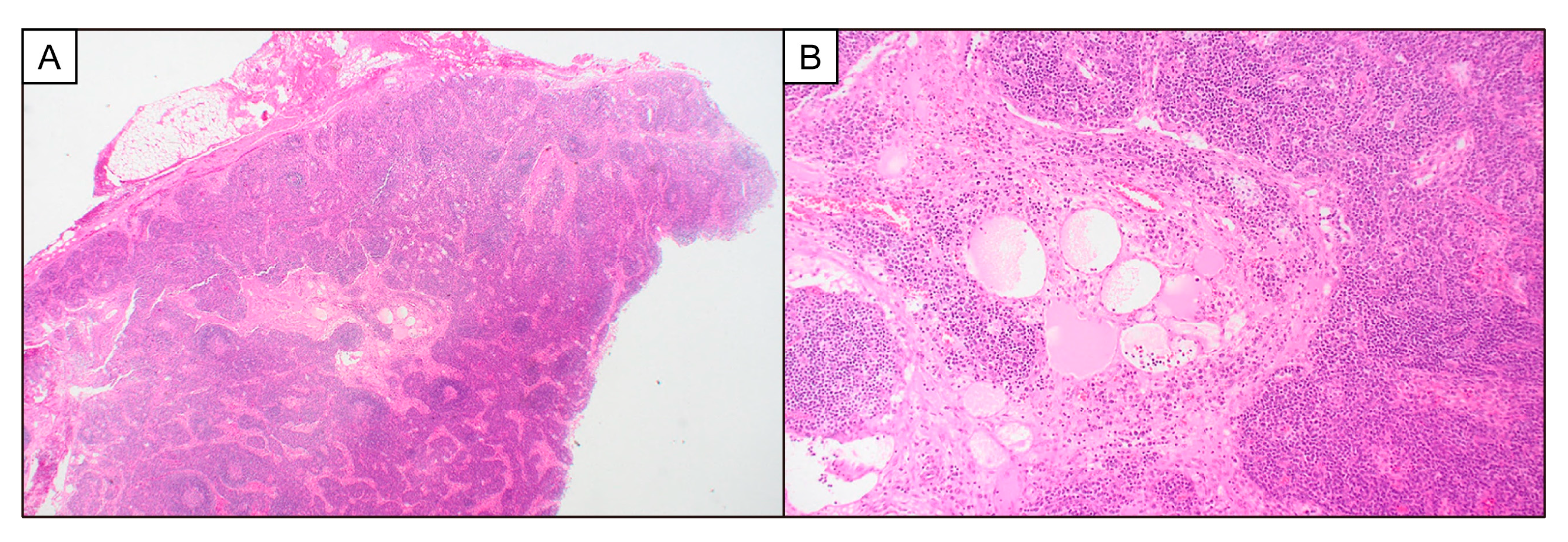Biomedicines 12 01070 g001