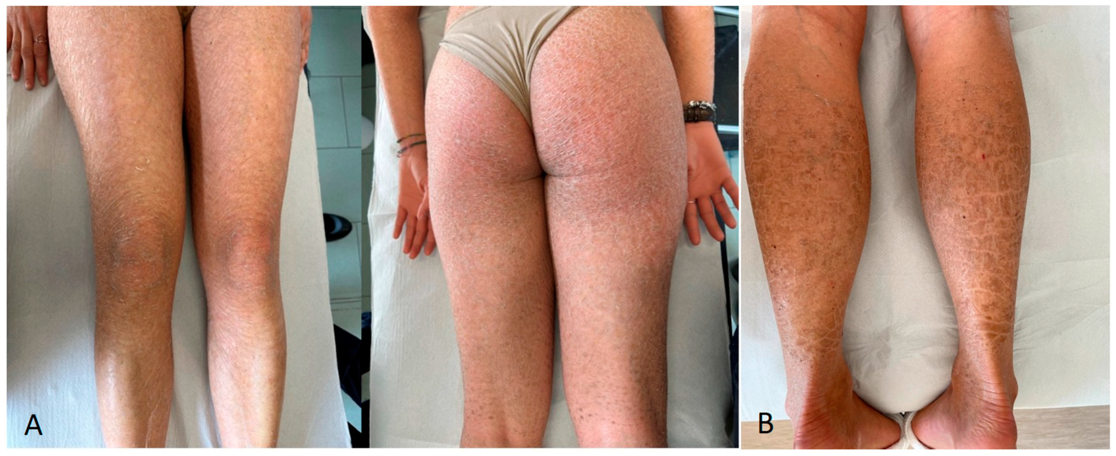 Biomedicines 12 01112 g003 Biomedicines 12 01112 g003