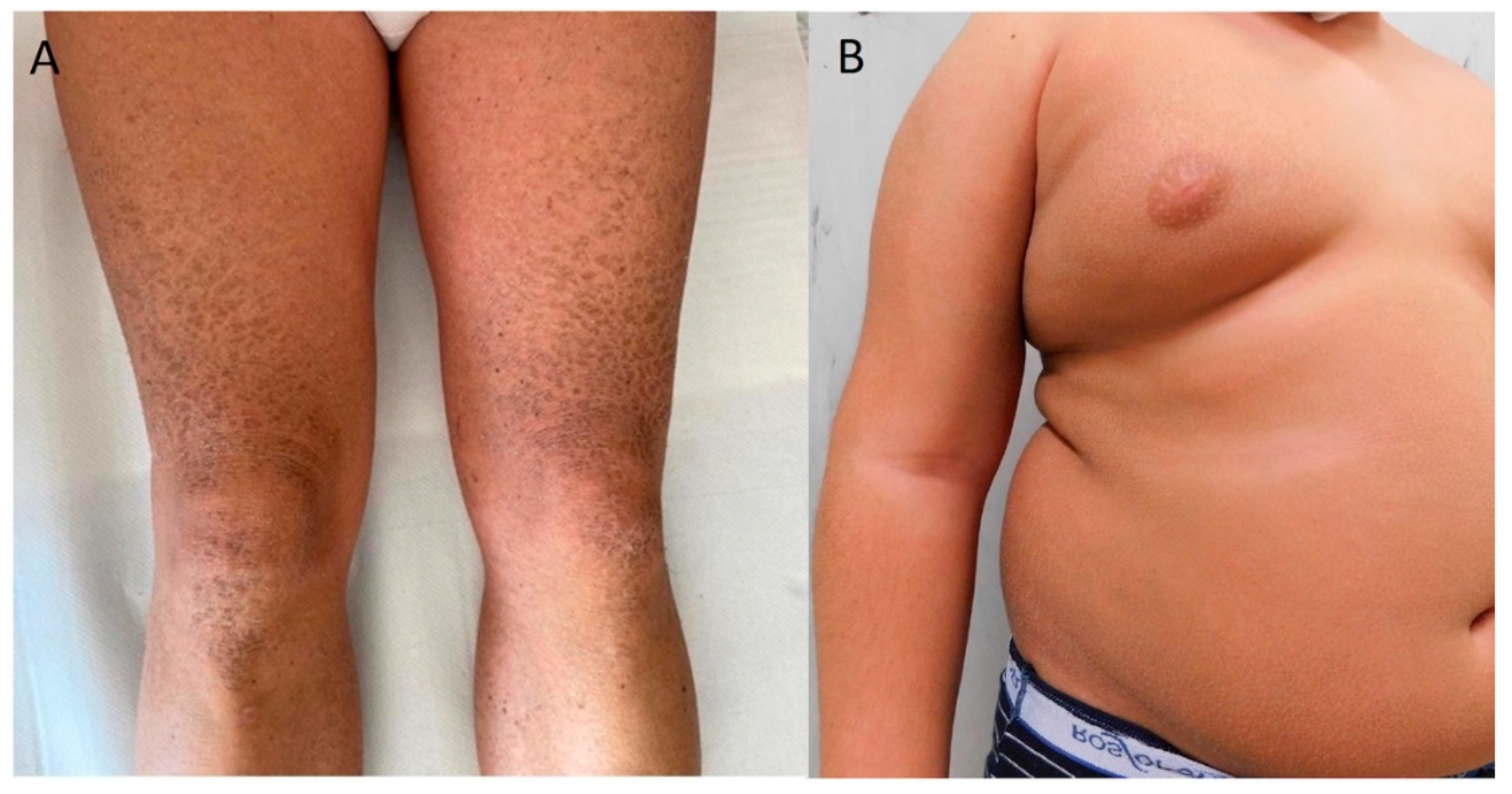 Biomedicines 12 01112 g005 Biomedicines 12 01112 g005