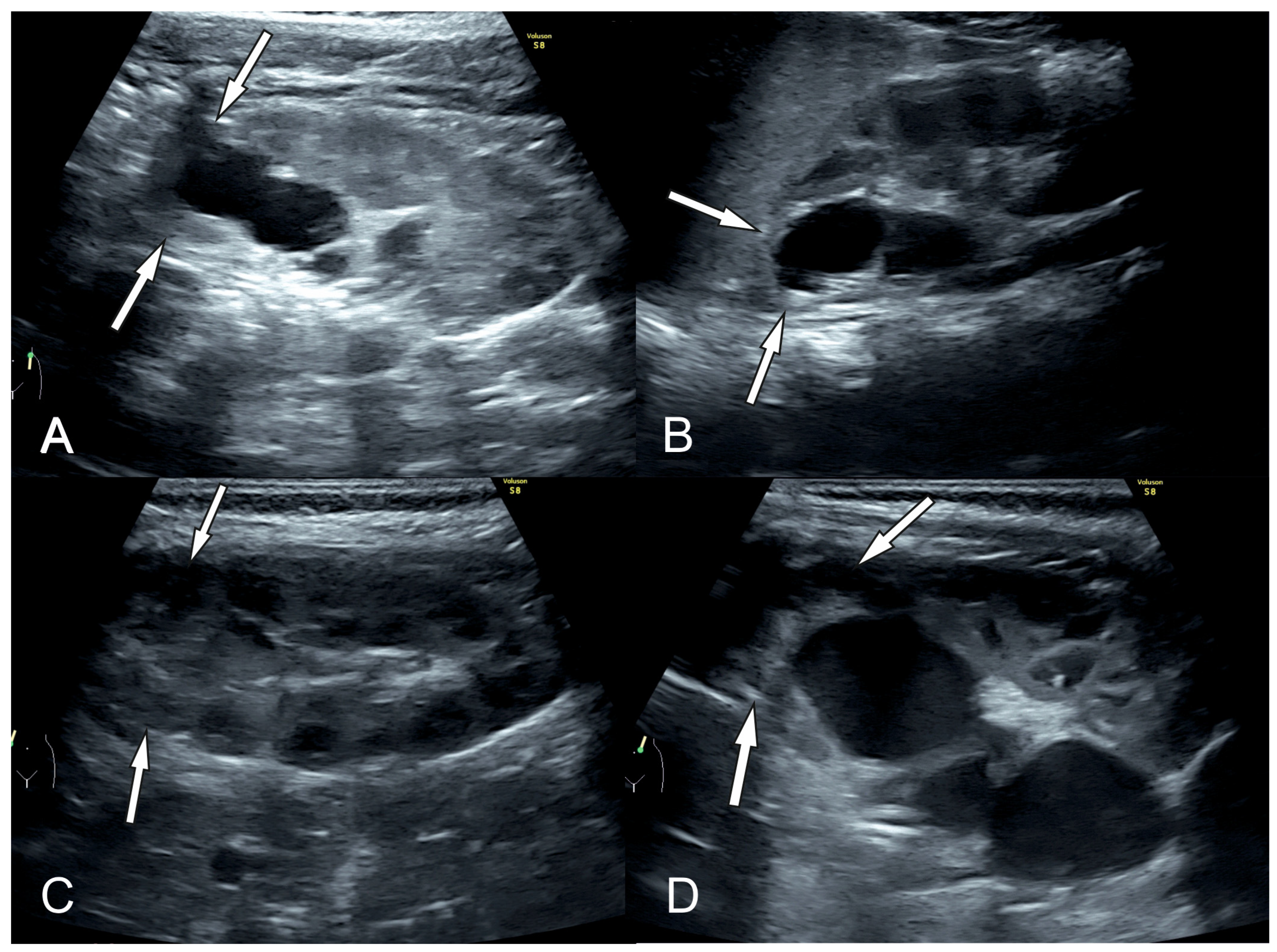 Biomedicines 12 01126 g003