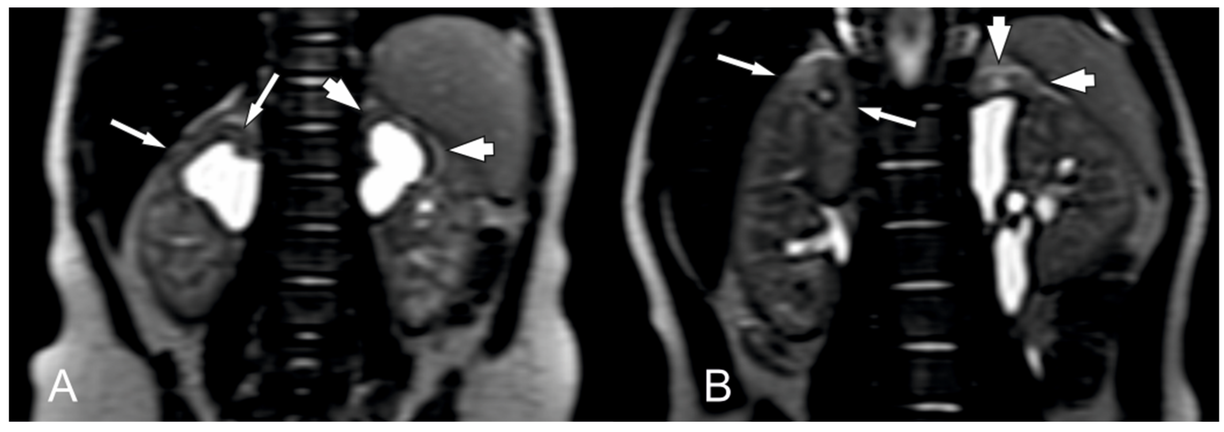 Biomedicines 12 01126 g004