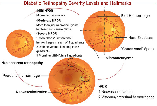 The Role of Natural Products in Diabetic Retinopathy