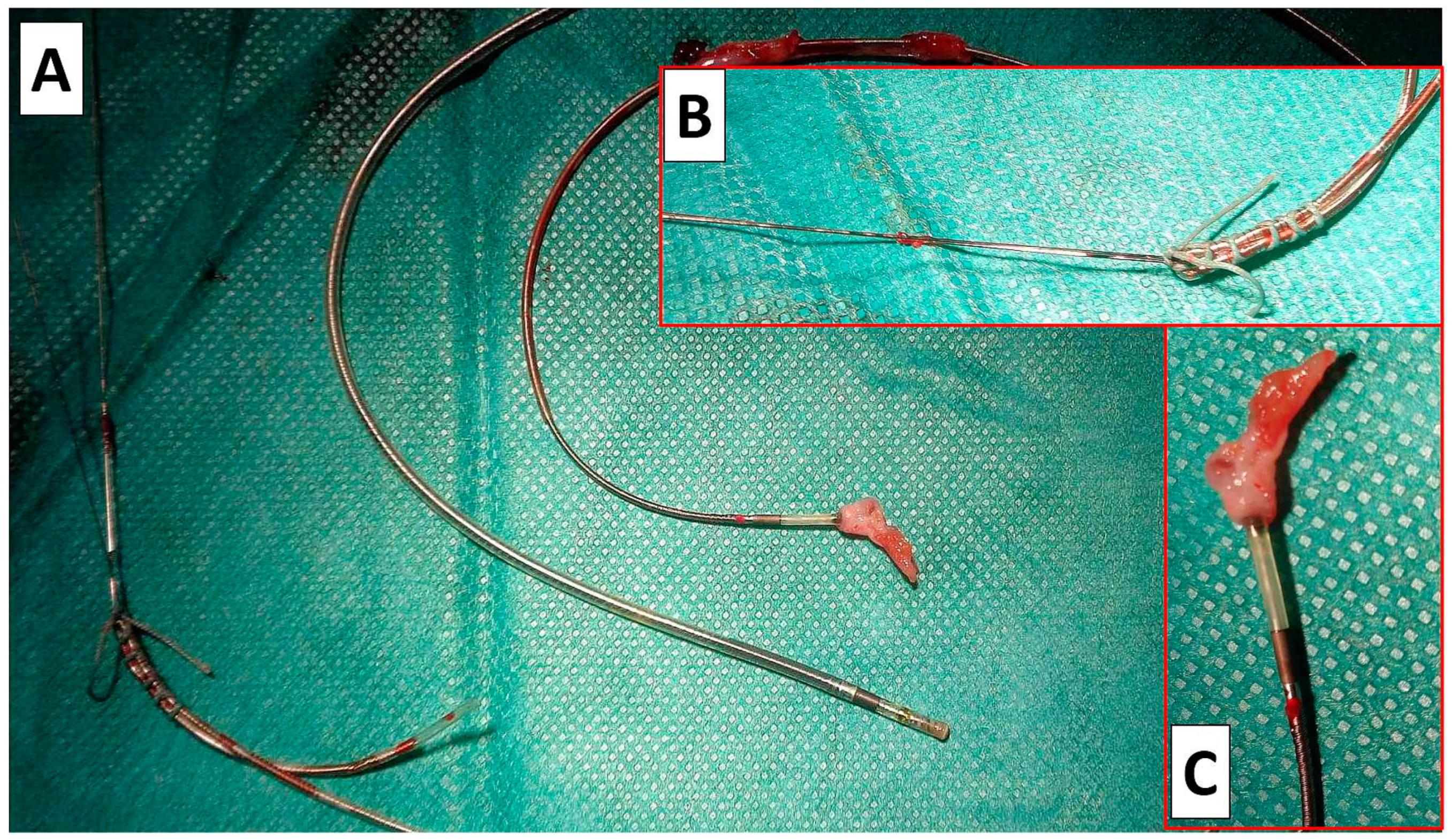 Biomedicines 12 01154 g001