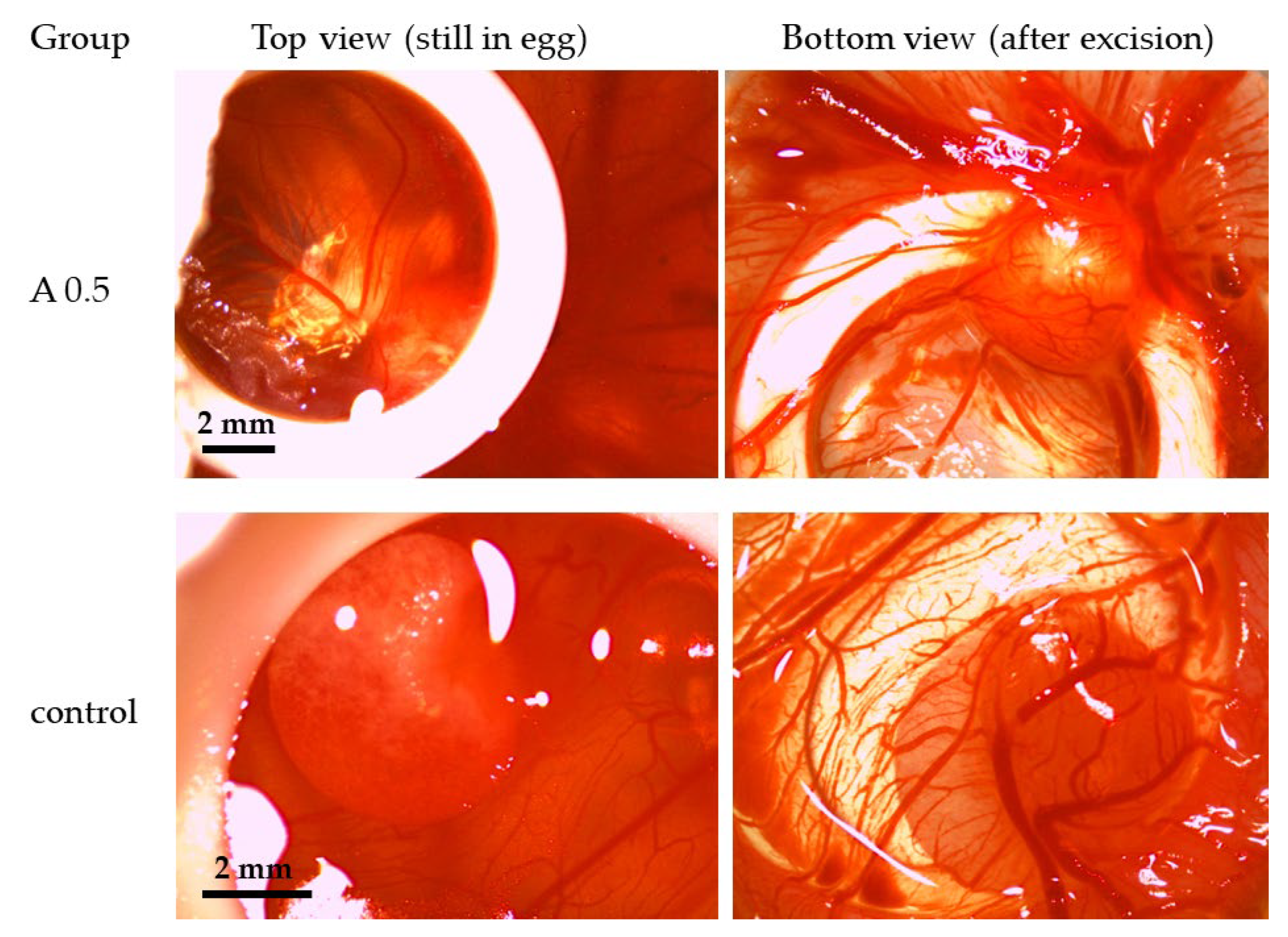 Biomedicines 12 01155 g0a3