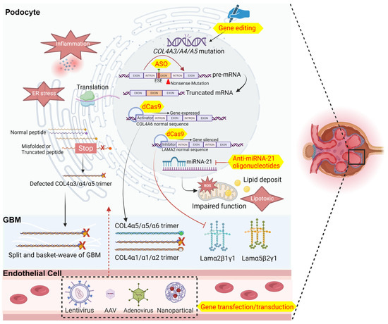 Exploration of Gene Therapy for Alport Syndrome