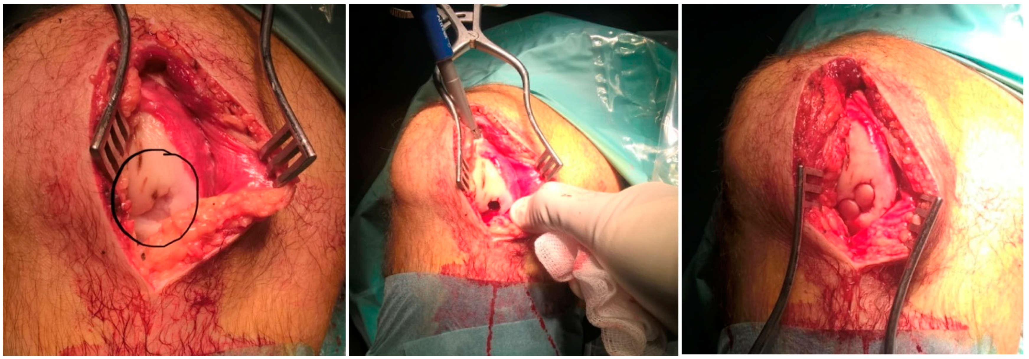 Biomedicines 12 01164 g001