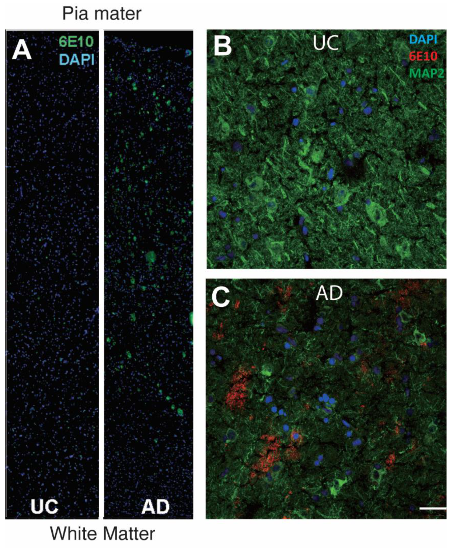 DNA Damage and Senescence in the Aging and Alzheimer's