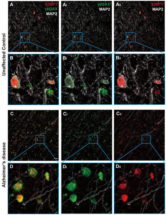 DNA / SCATTER THE BRAIN ジャパメタ VIRUS West Nile Virus-Induced Expression of Senescent Gene