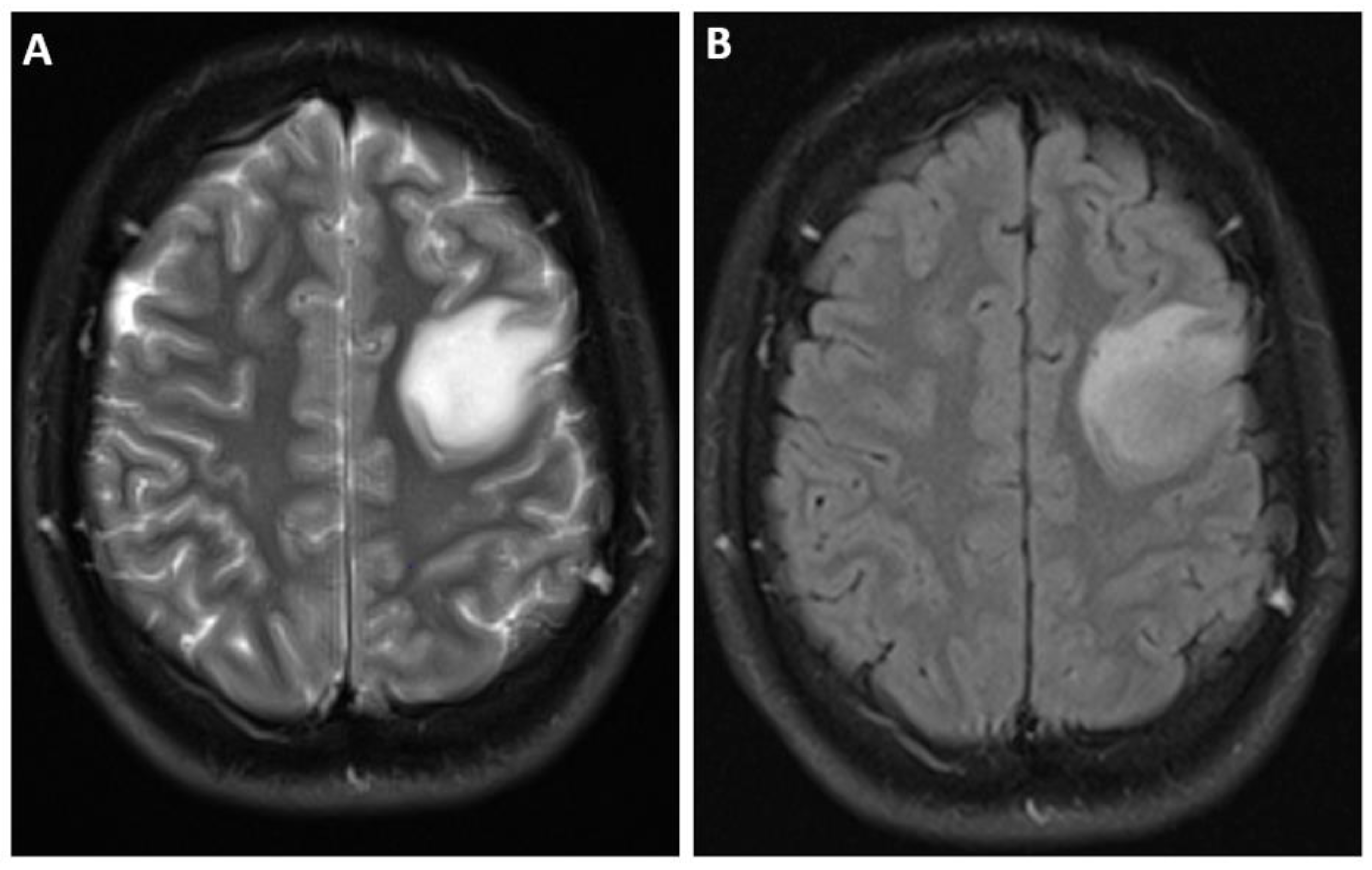 Biomedicines 12 01349 g002 Biomedicines 12 01349 g002