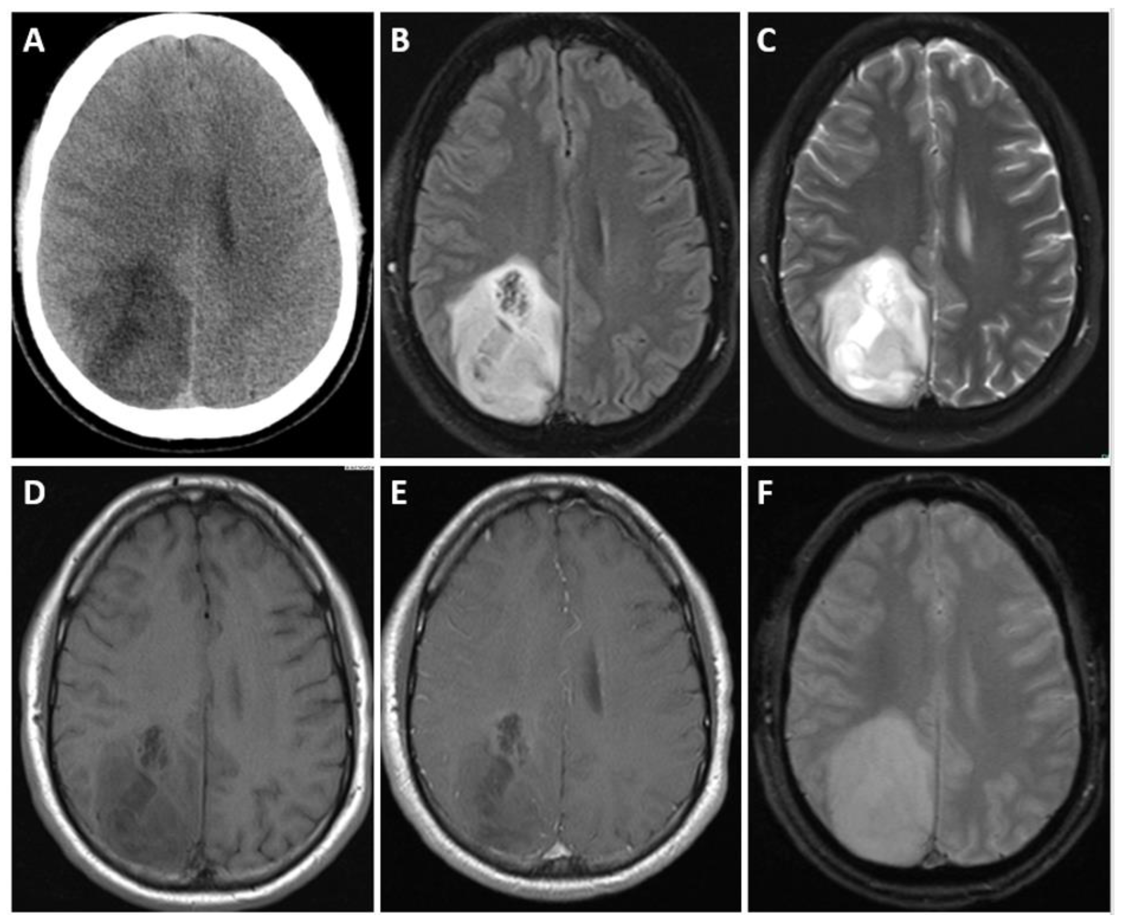 Biomedicines 12 01349 g003 Biomedicines 12 01349 g003
