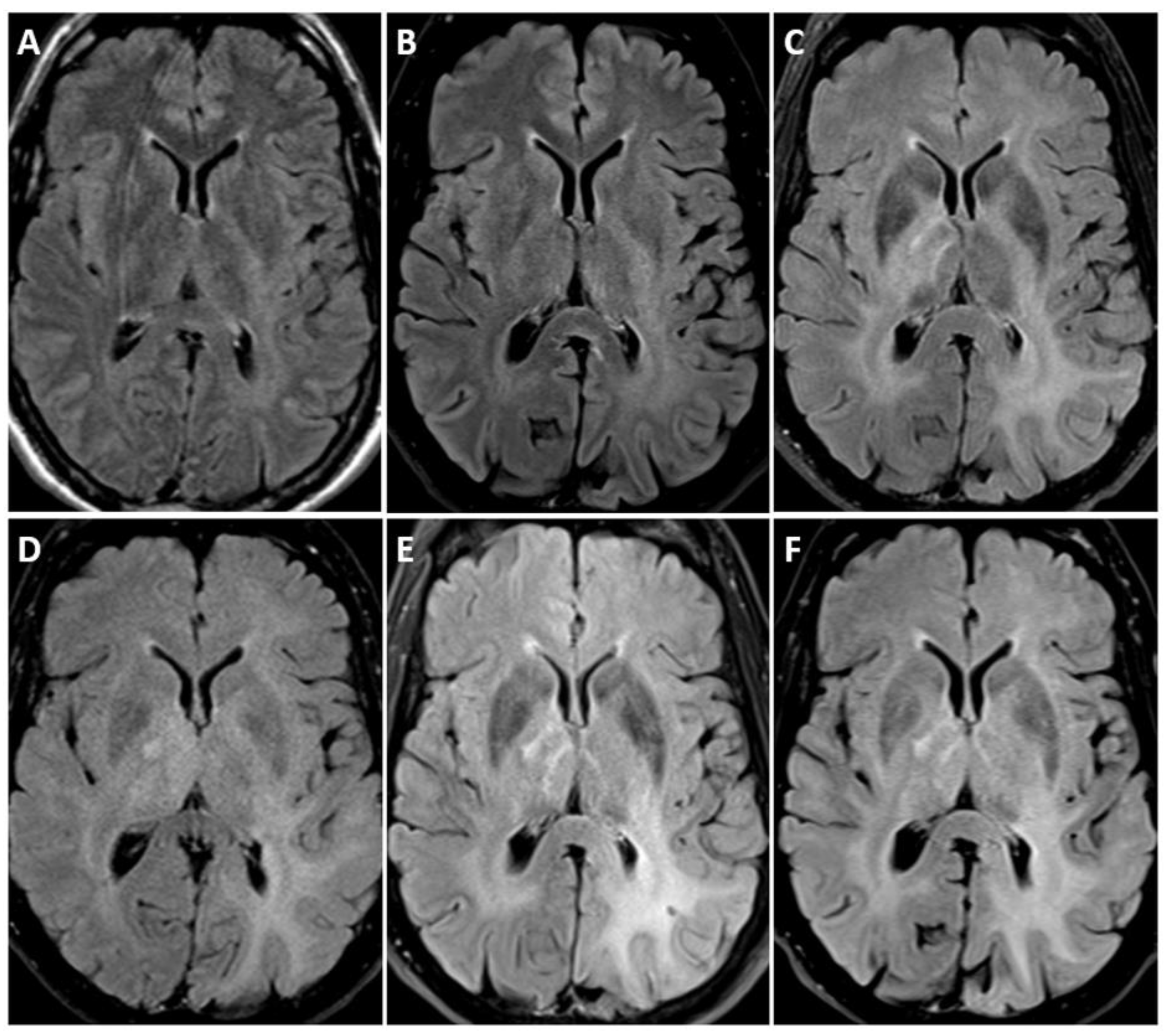 Biomedicines 12 01349 g005 Biomedicines 12 01349 g005