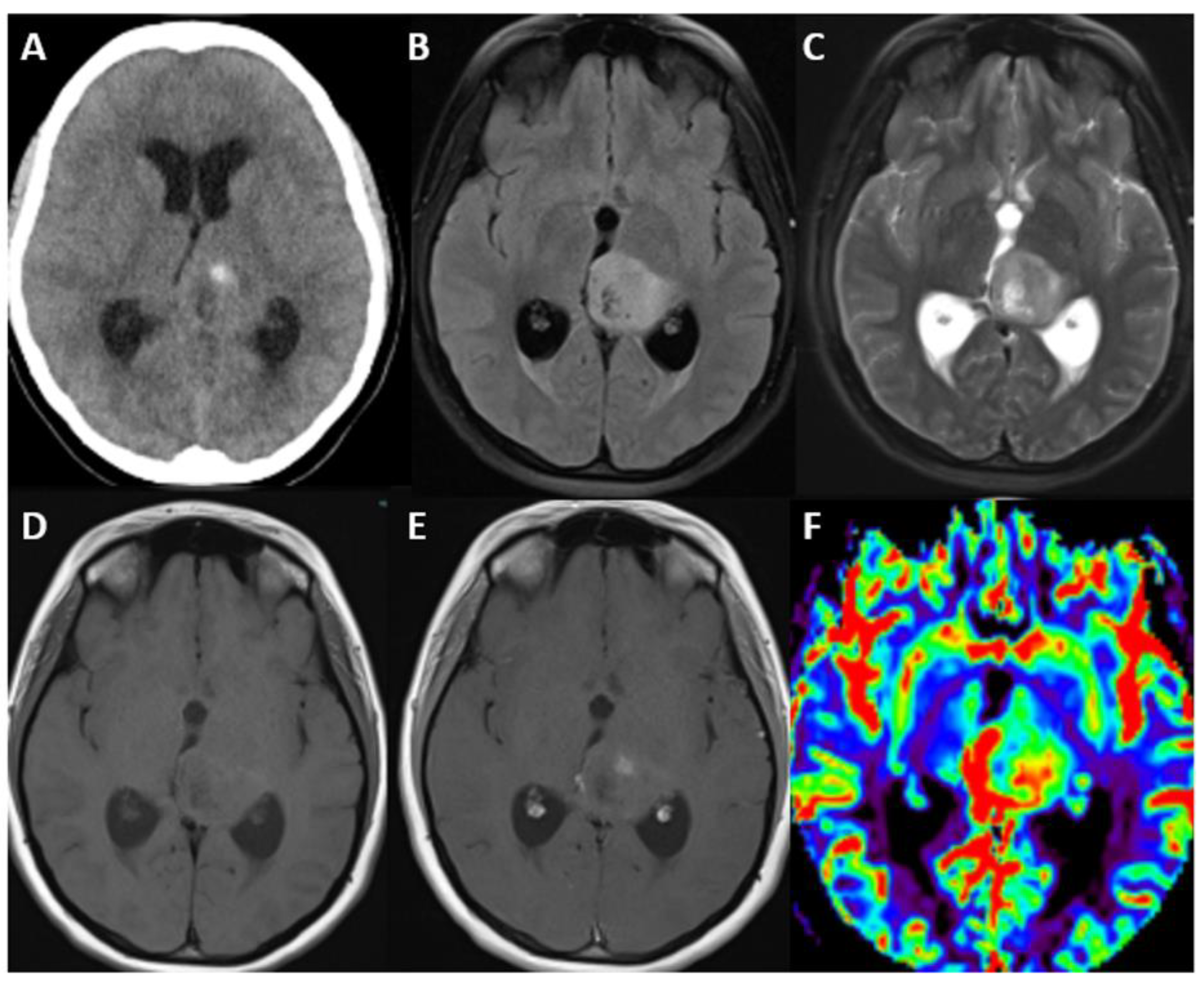 Biomedicines 12 01349 g007 Biomedicines 12 01349 g007