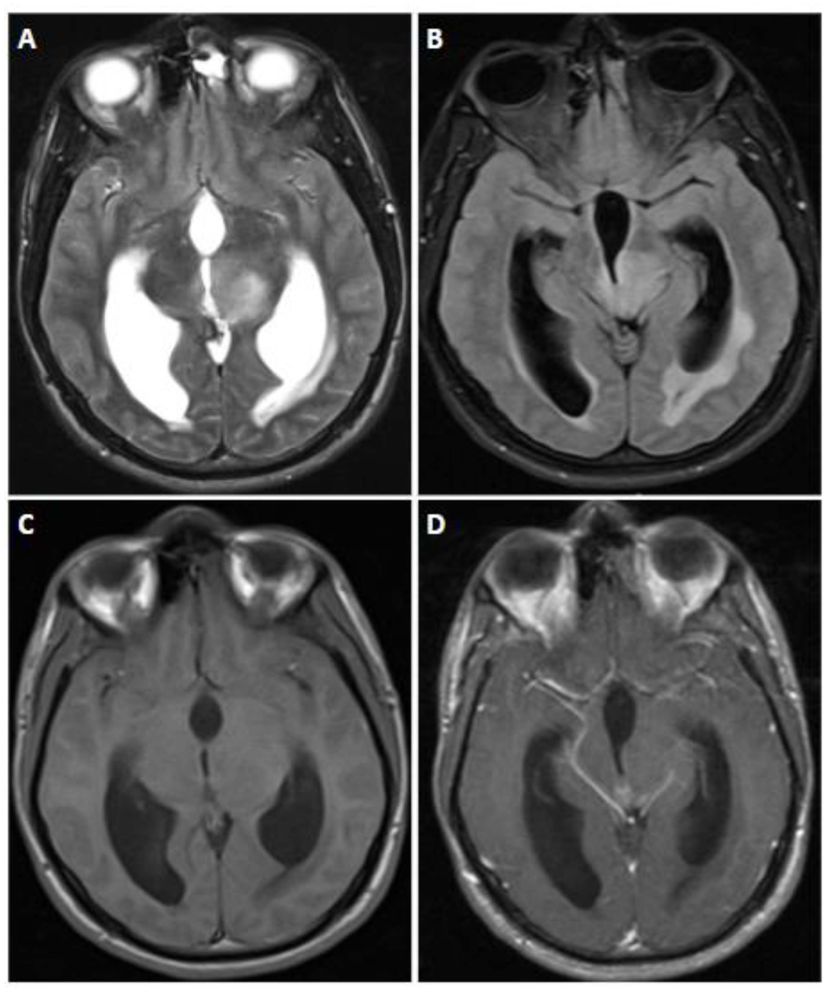 Biomedicines 12 01349 g010 Biomedicines 12 01349 g010