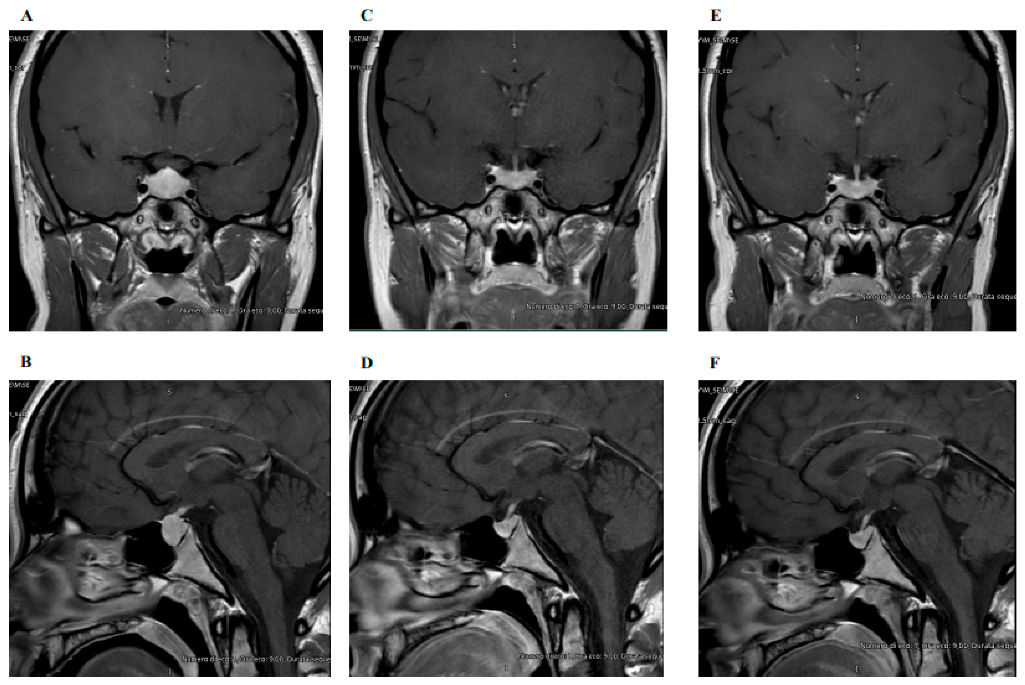 Biomedicines 12 01368 g002 Biomedicines 12 01368 g002