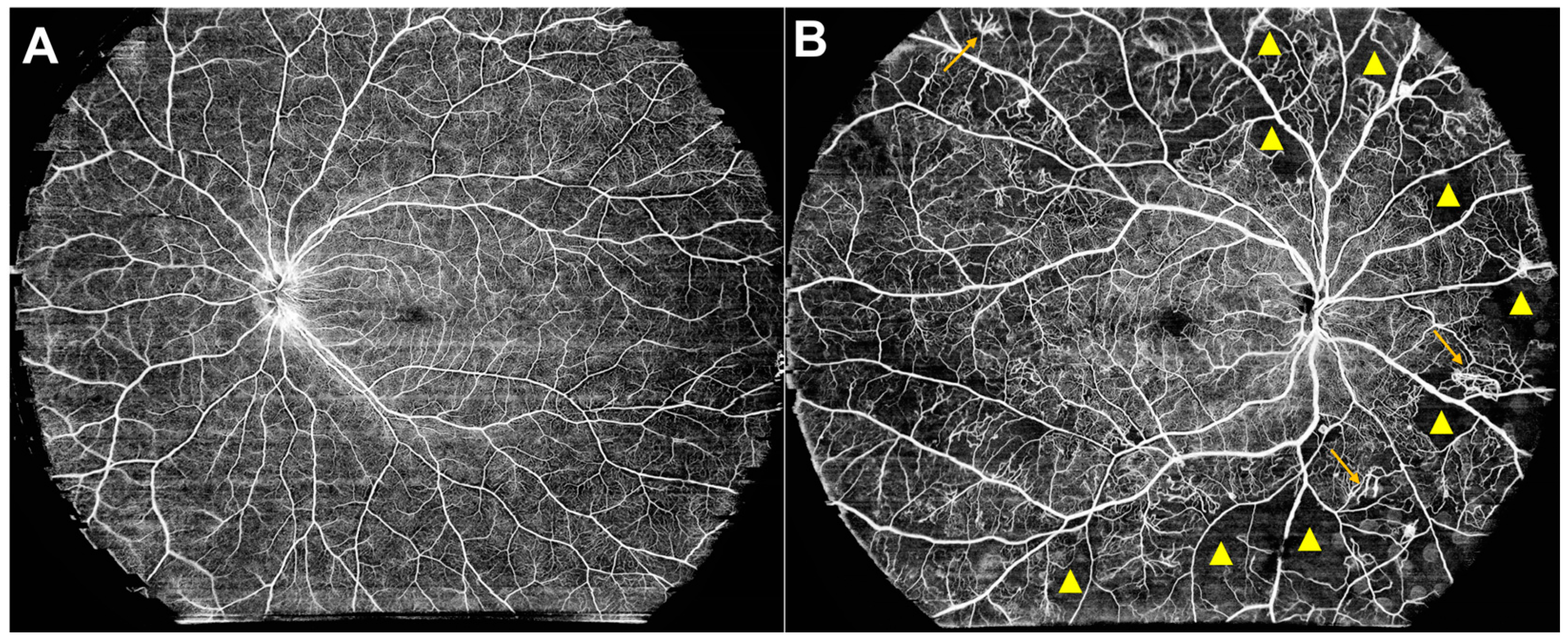 Biomedicines 12 01405 g002 Biomedicines 12 01405 g002