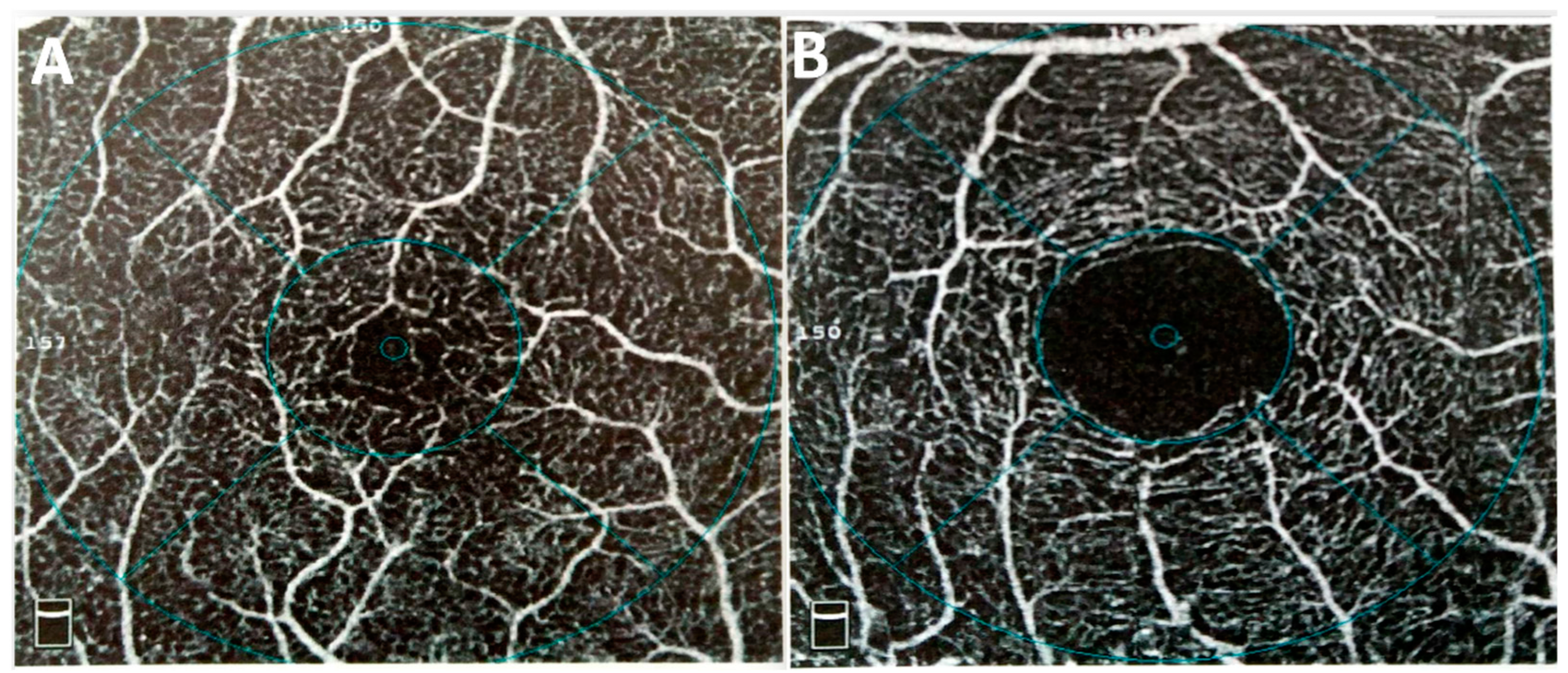 Biomedicines 12 01405 g003 Biomedicines 12 01405 g003
