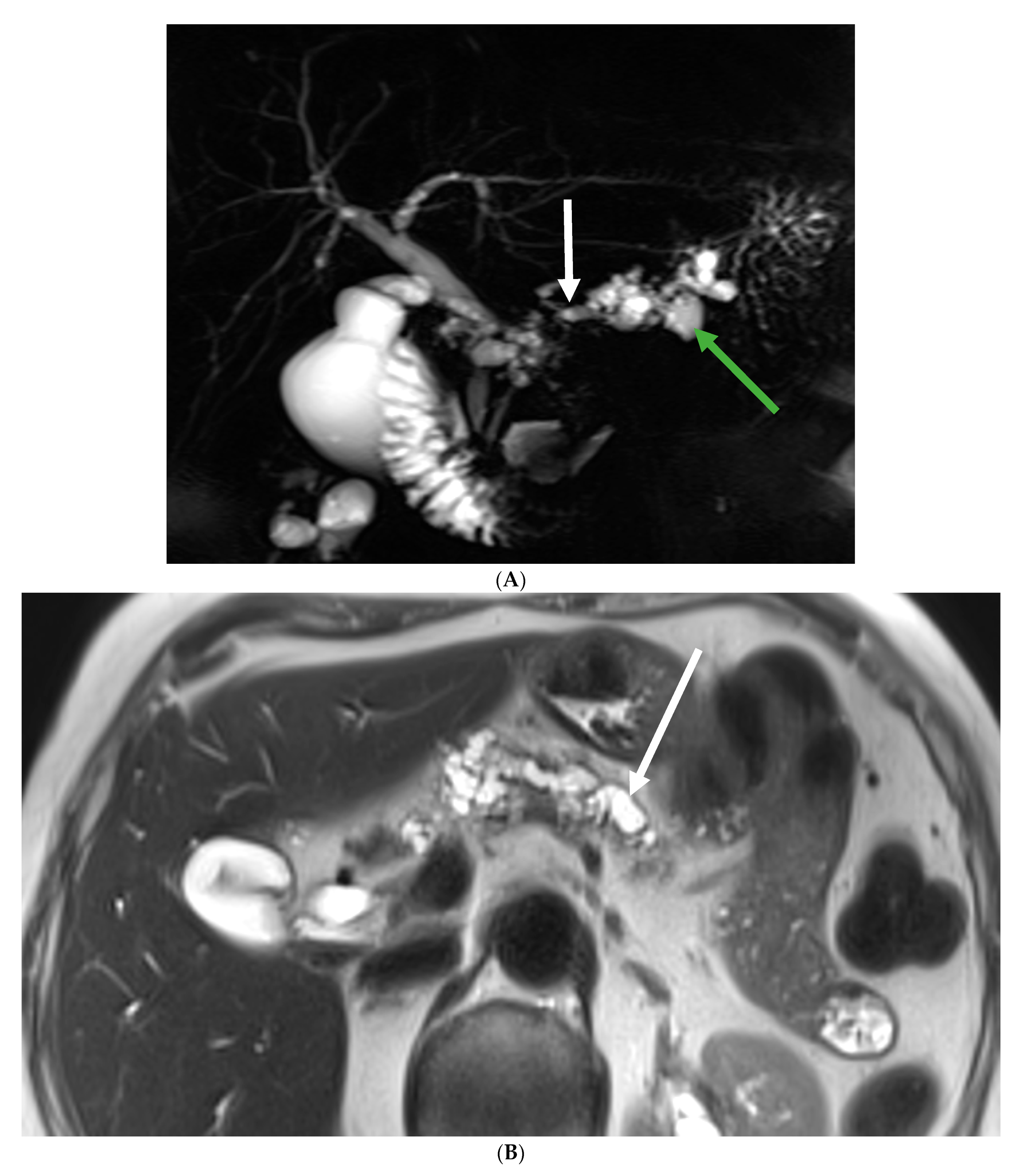 Biomedicines 12 01437 g001a