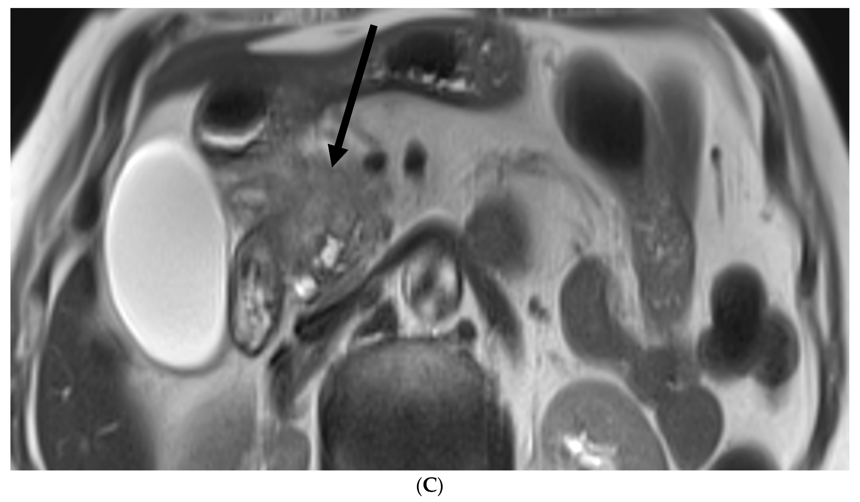 Biomedicines 12 01437 g001b