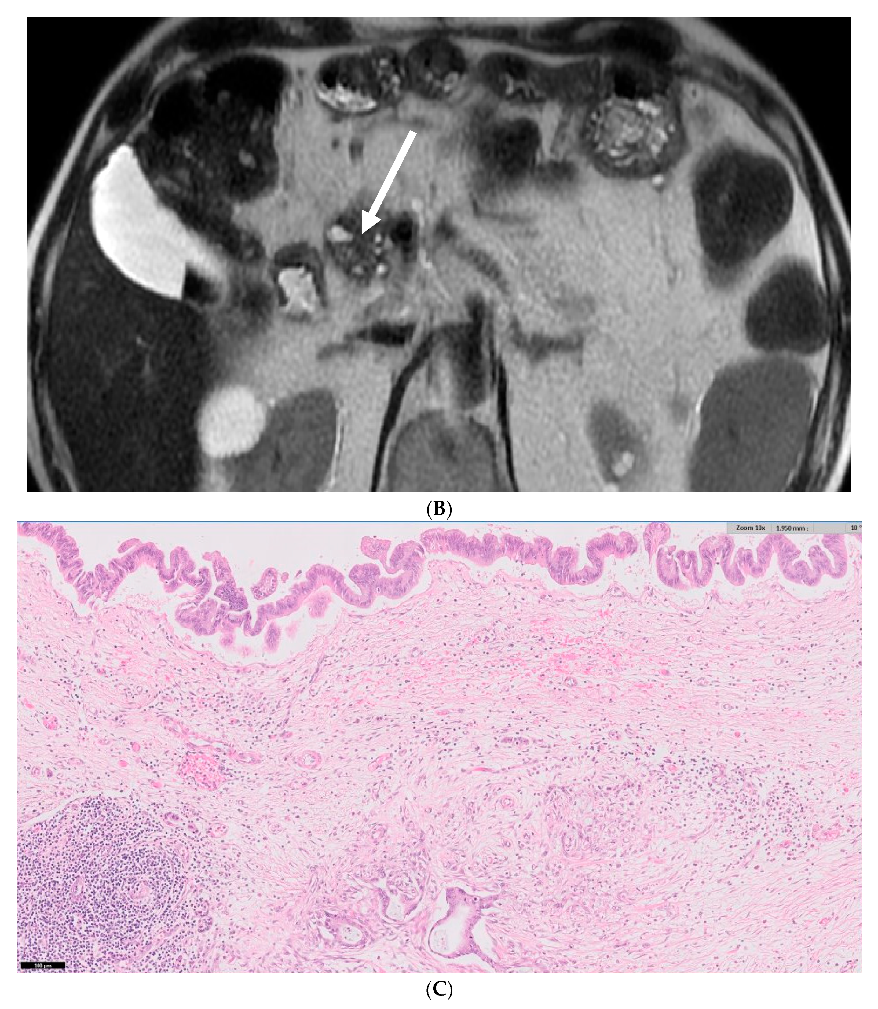 Biomedicines 12 01437 g002b