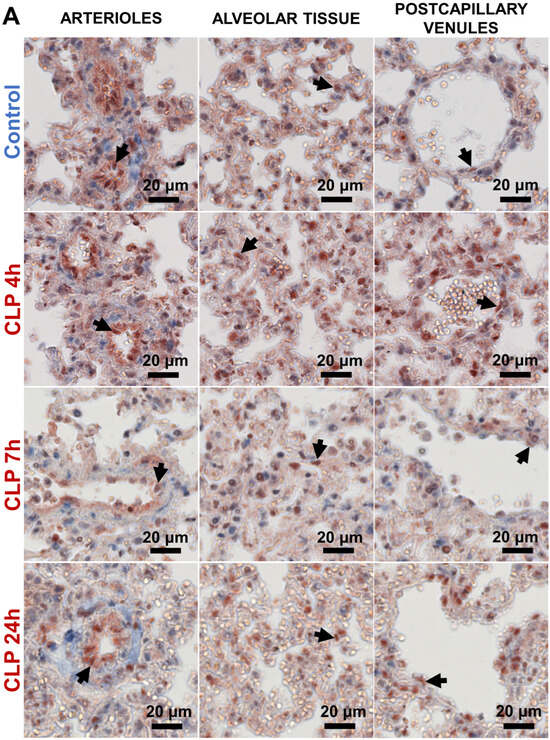 Heterogeneous Patterns of Endothelial NF-κB p65 and MAPK c-Jun