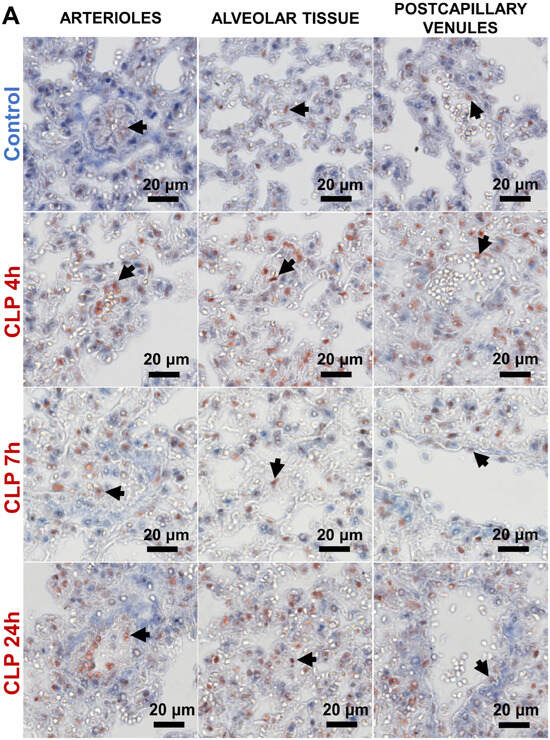 seri Re-introducing the new SYM CROX series. Crox 150 cc - Rs