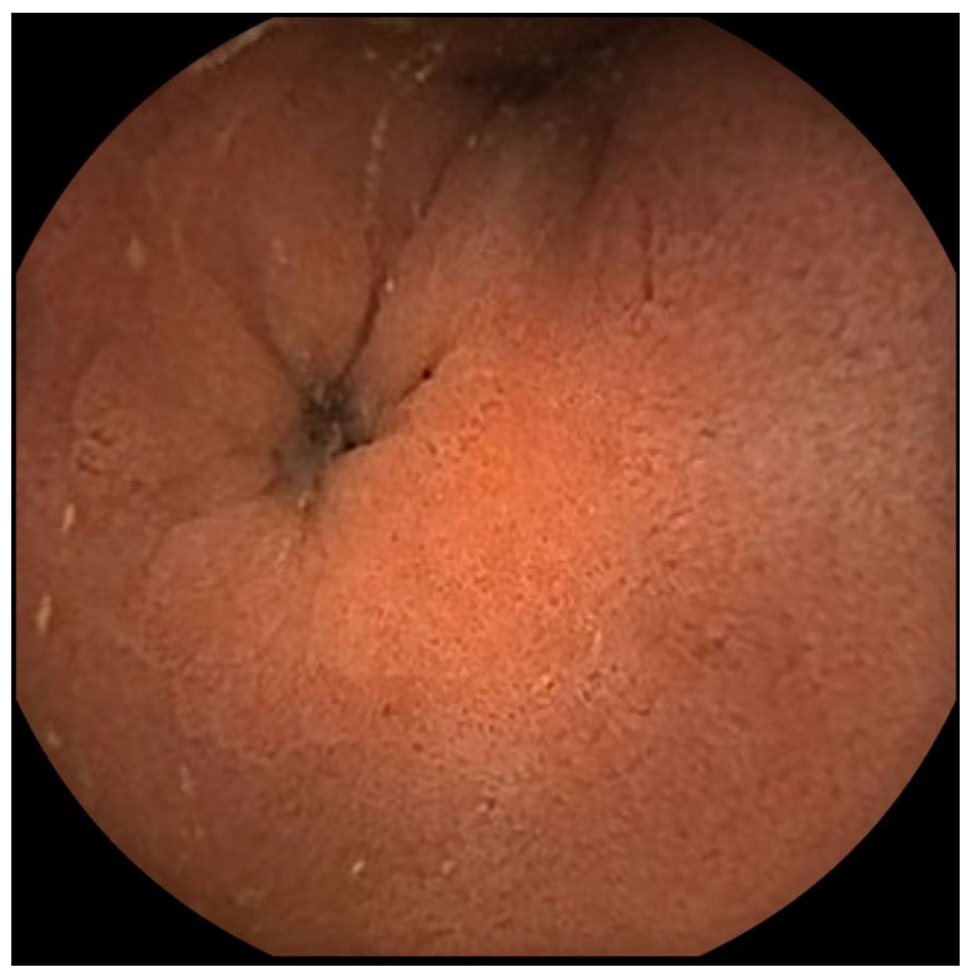 Biomedicines 12 01704 g0a2