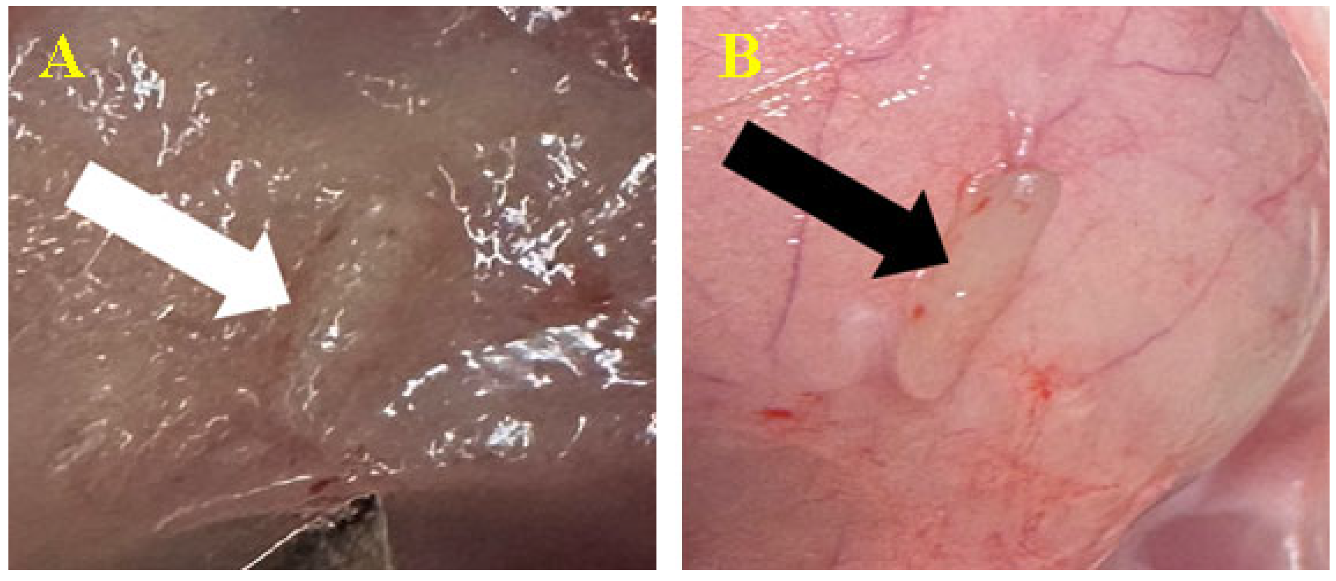 Biomedicines 12 01718 g004