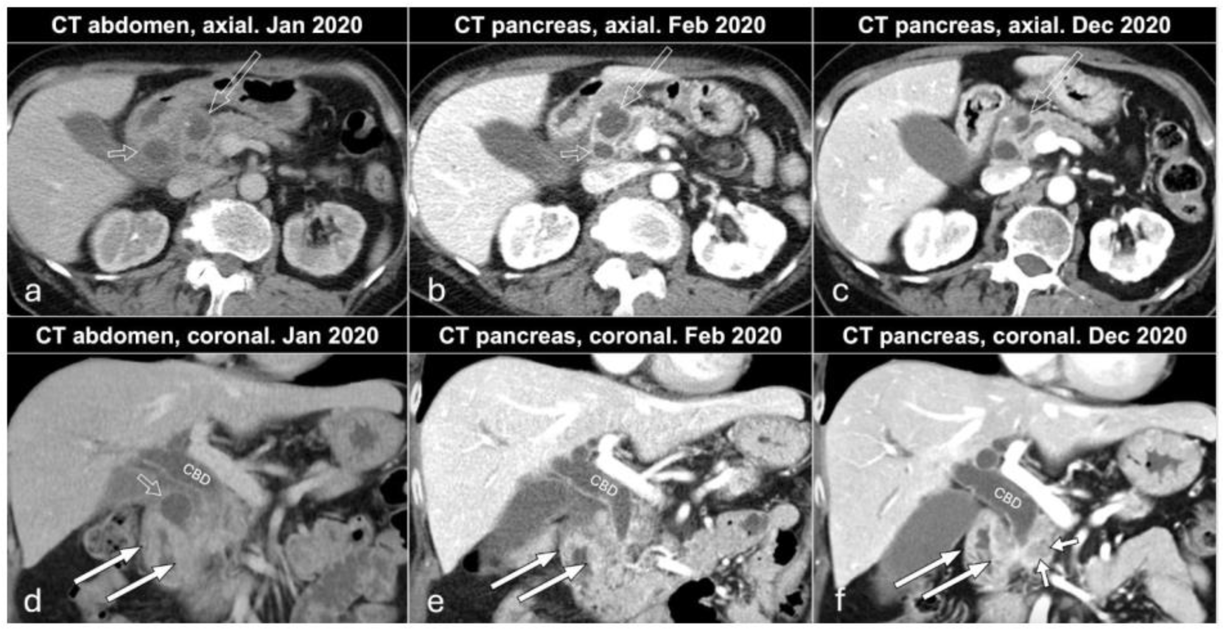 Biomedicines 12 01762 g001