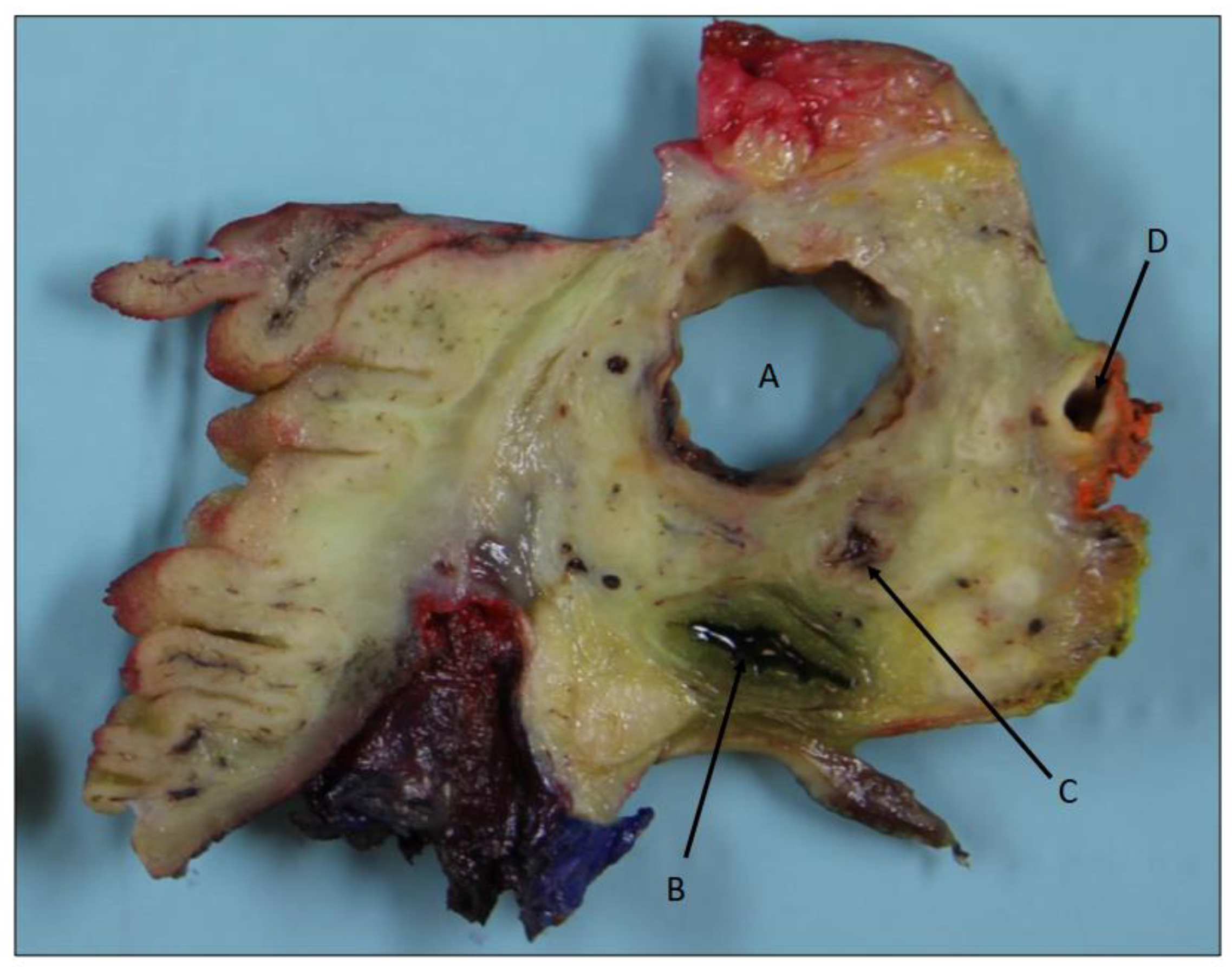 Biomedicines 12 01762 g003