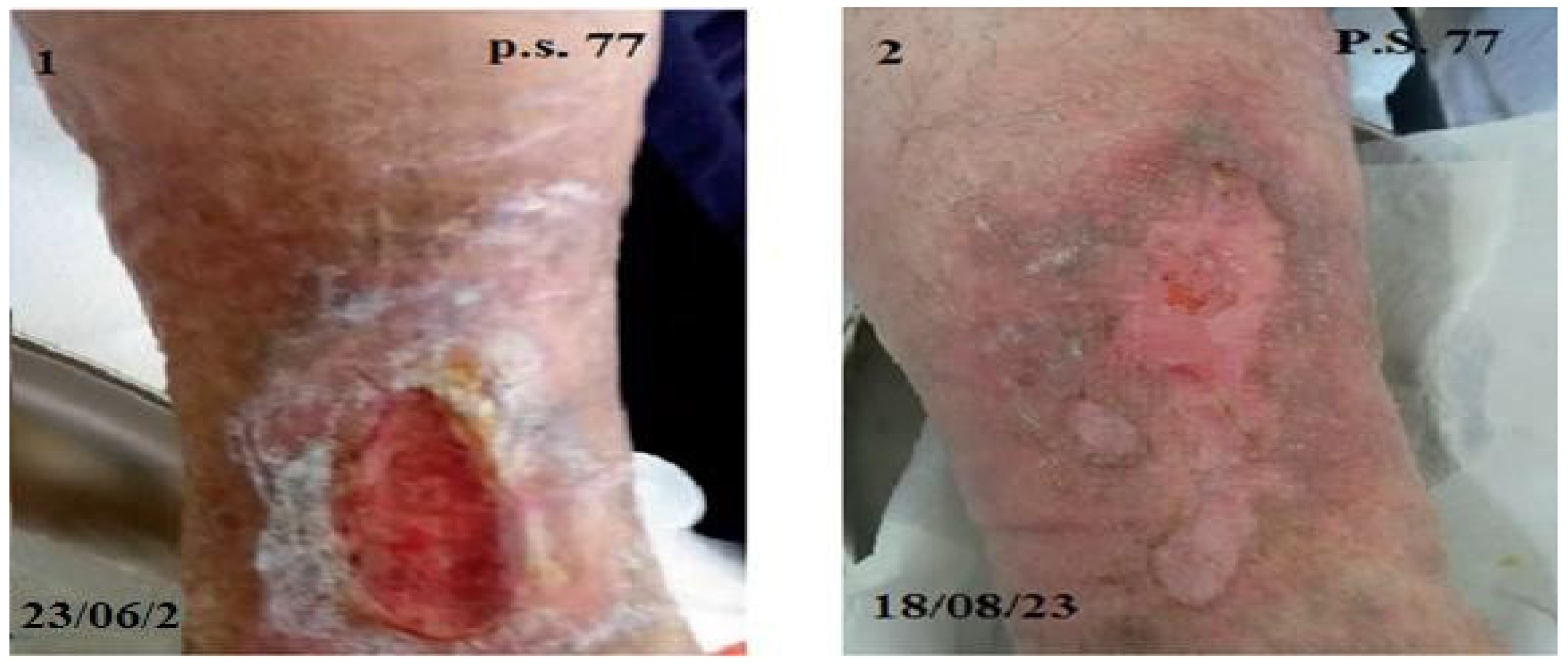 Biomedicines 12 01918 g005 Biomedicines 12 01918 g005