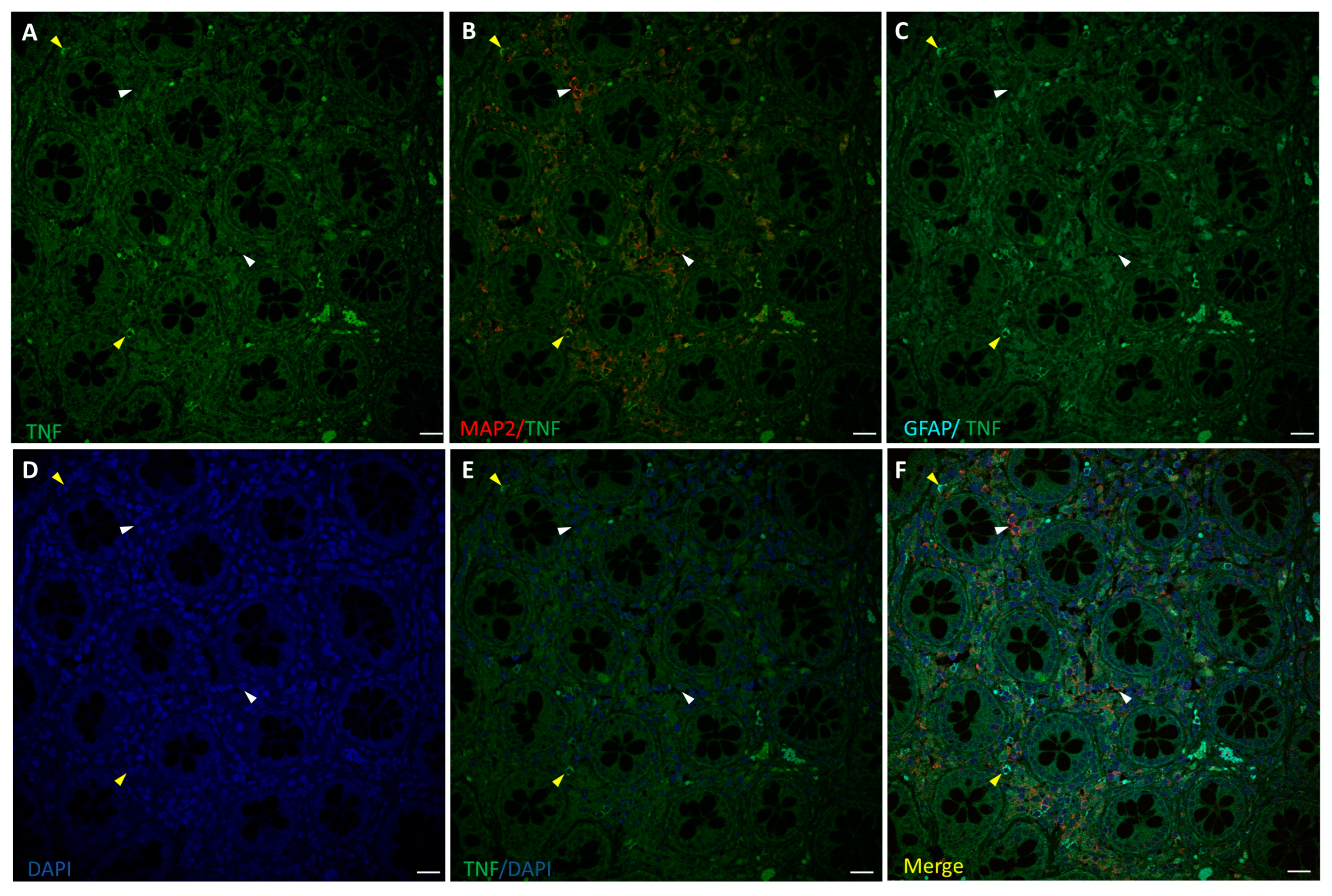 Biomedicines 12 01952 g003