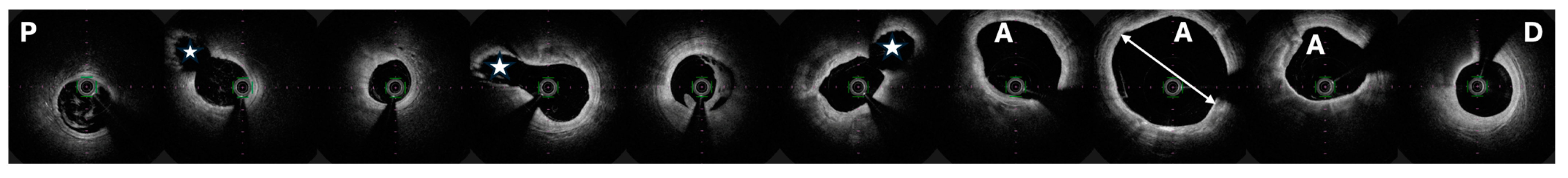 Biomedicines 12 01984 g006 Biomedicines 12 01984 g006