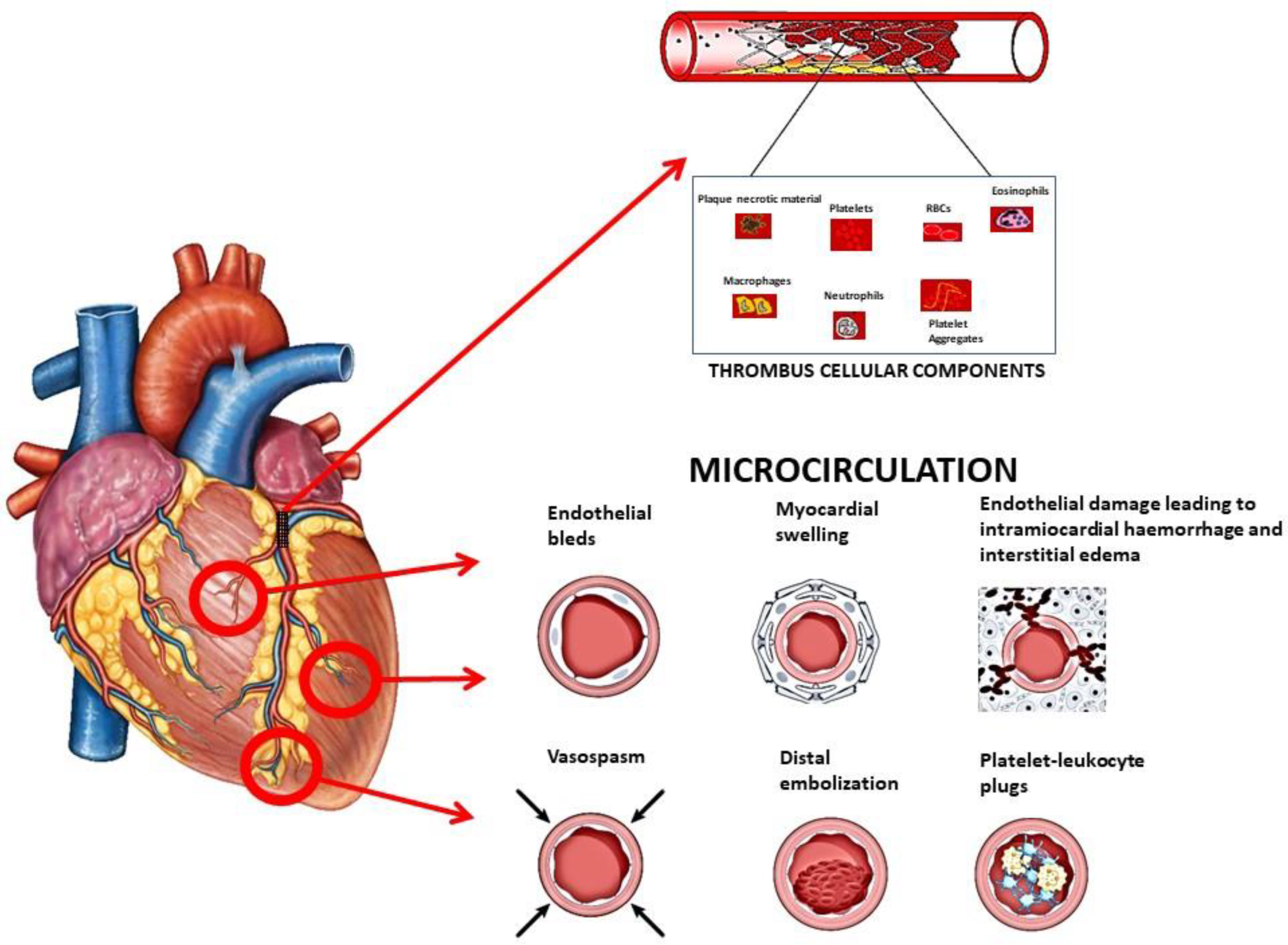 【SABBATICAL】 GLIA Current and Future Roles of Glycoprotein IIb–IIIa Inhibitors