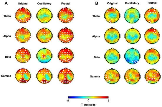 Resting-State EEG Alterations of Practice-Related Spectral