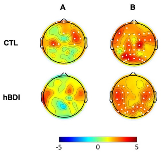 eeg 2011年 41597_2025_5187_Fig4_HTML.png
