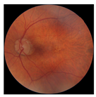 Biomedicines 12 02092 i007