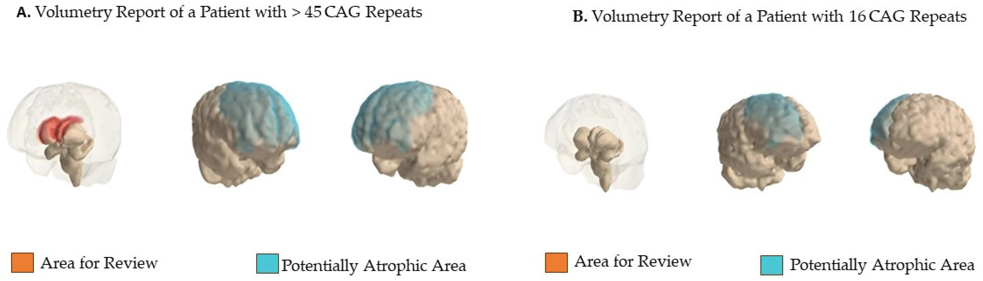 Biomedicines 12 02166 sch001