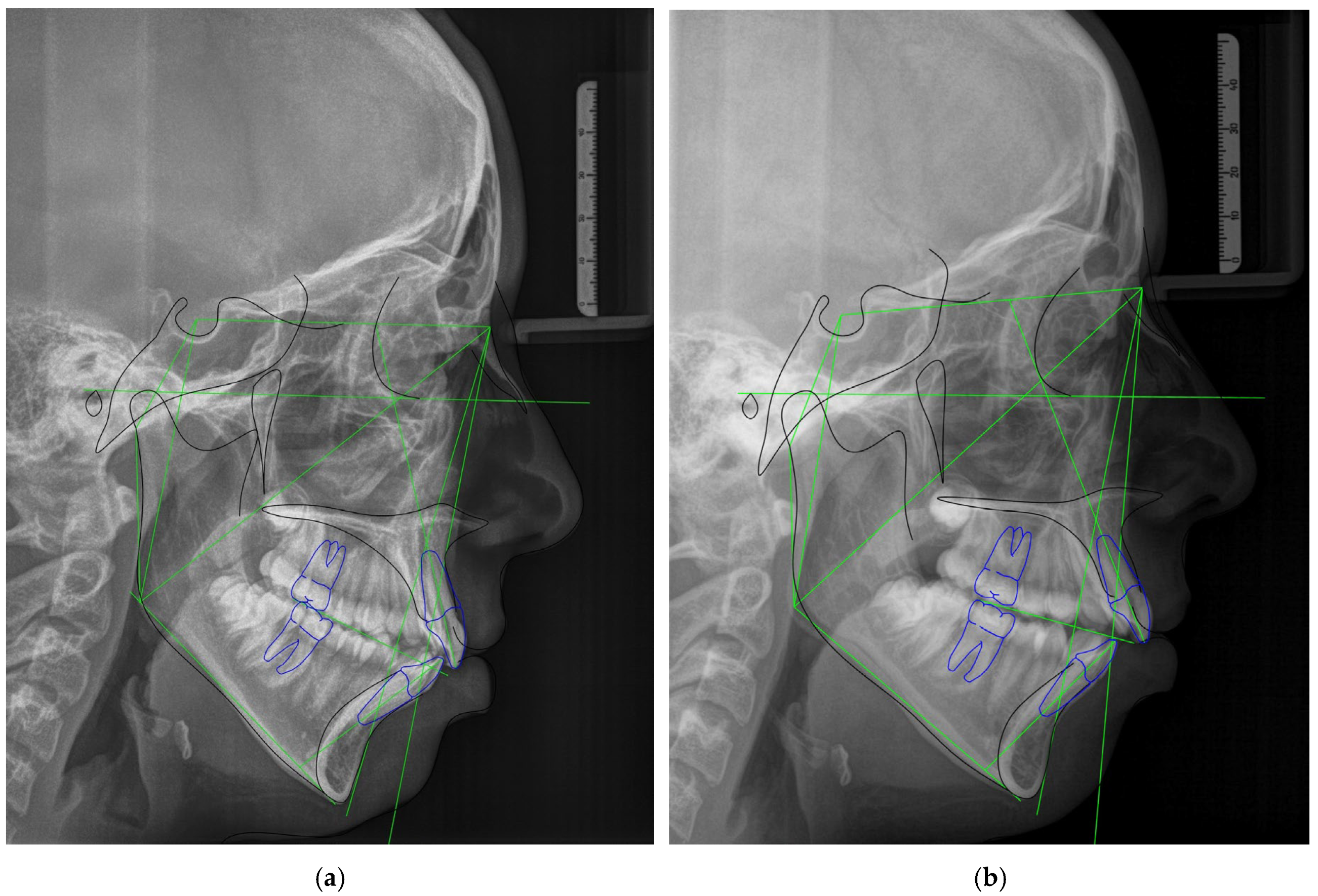 Biomedicines 12 02251 g006