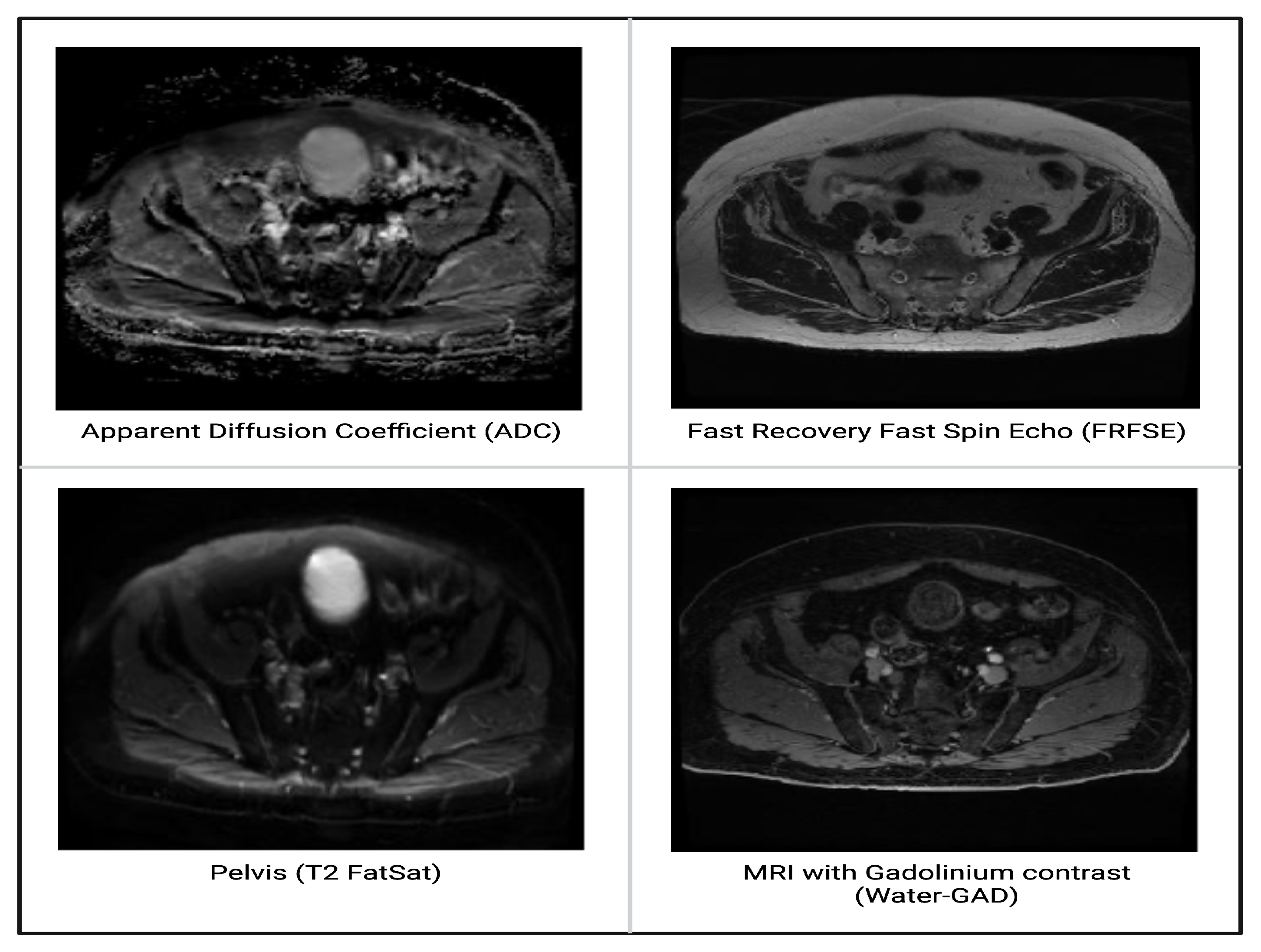 Biomedicines 12 02345 g004 Biomedicines 12 02345 g004