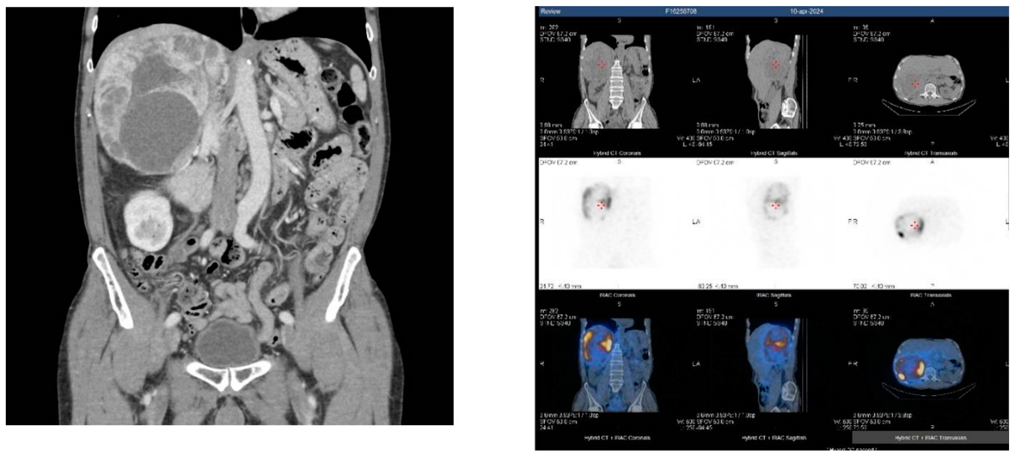Biomedicines 12 02385 g003
