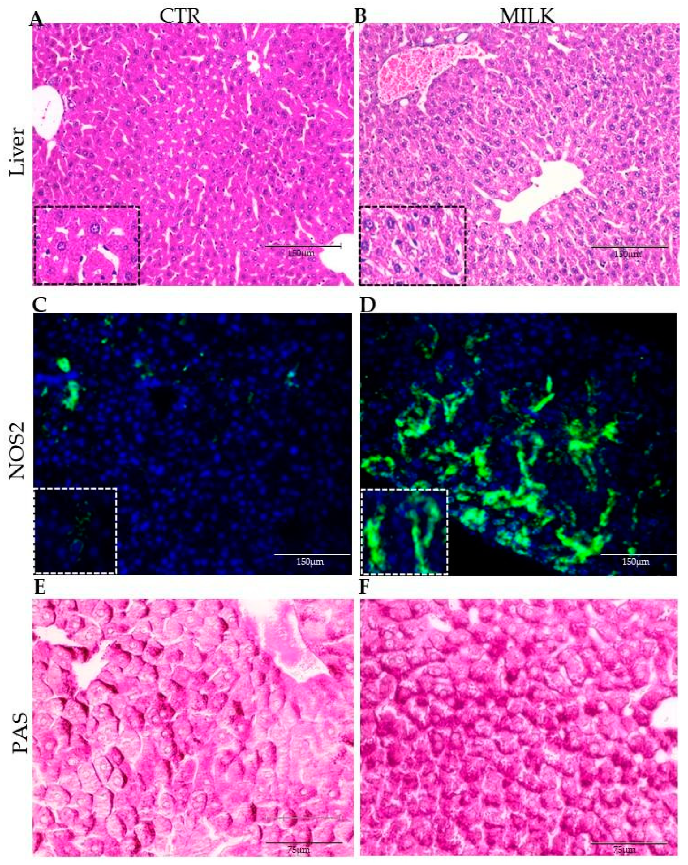 Biomedicines 12 02448 g004