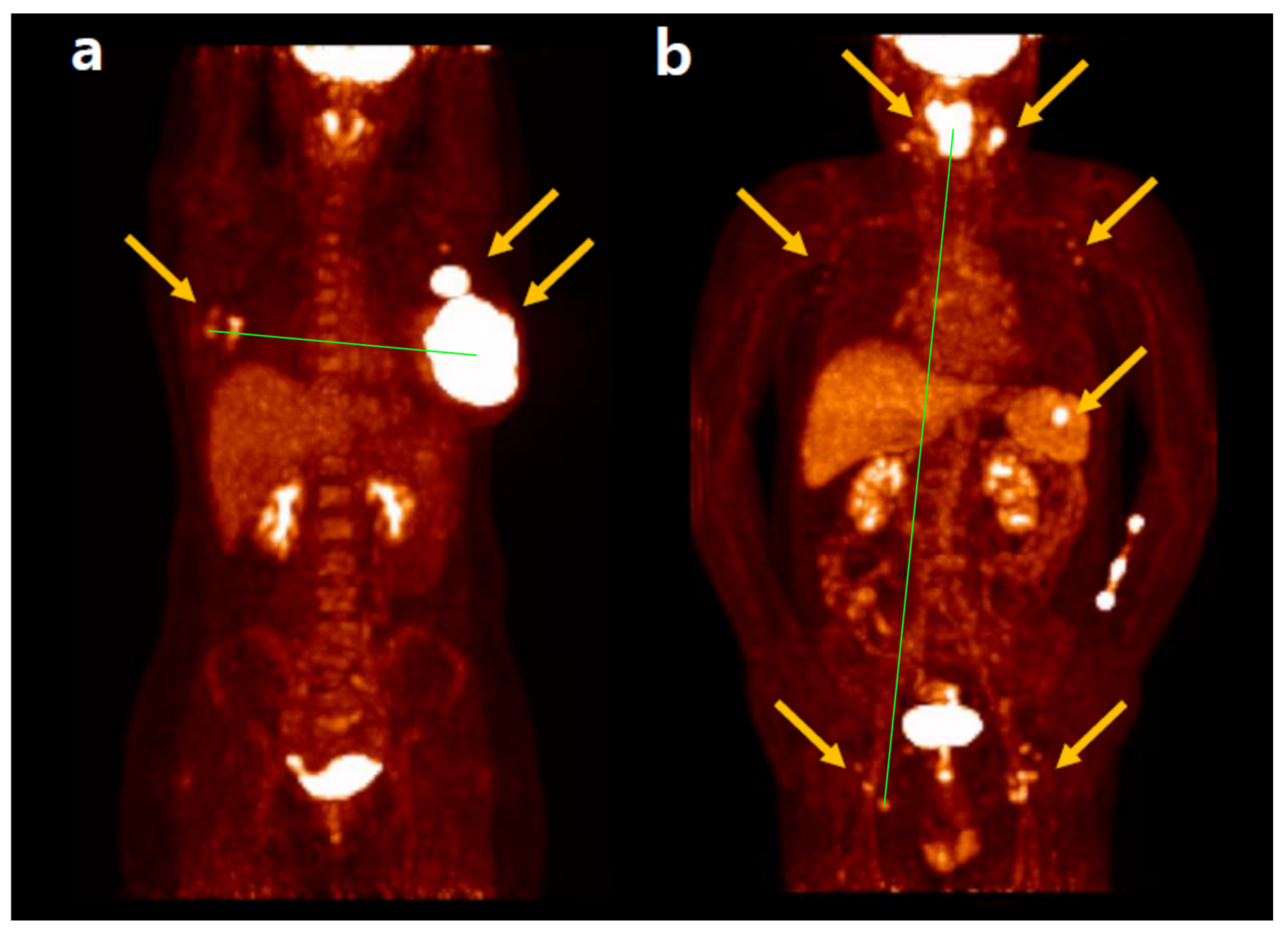 Biomedicines 12 02485 g001
