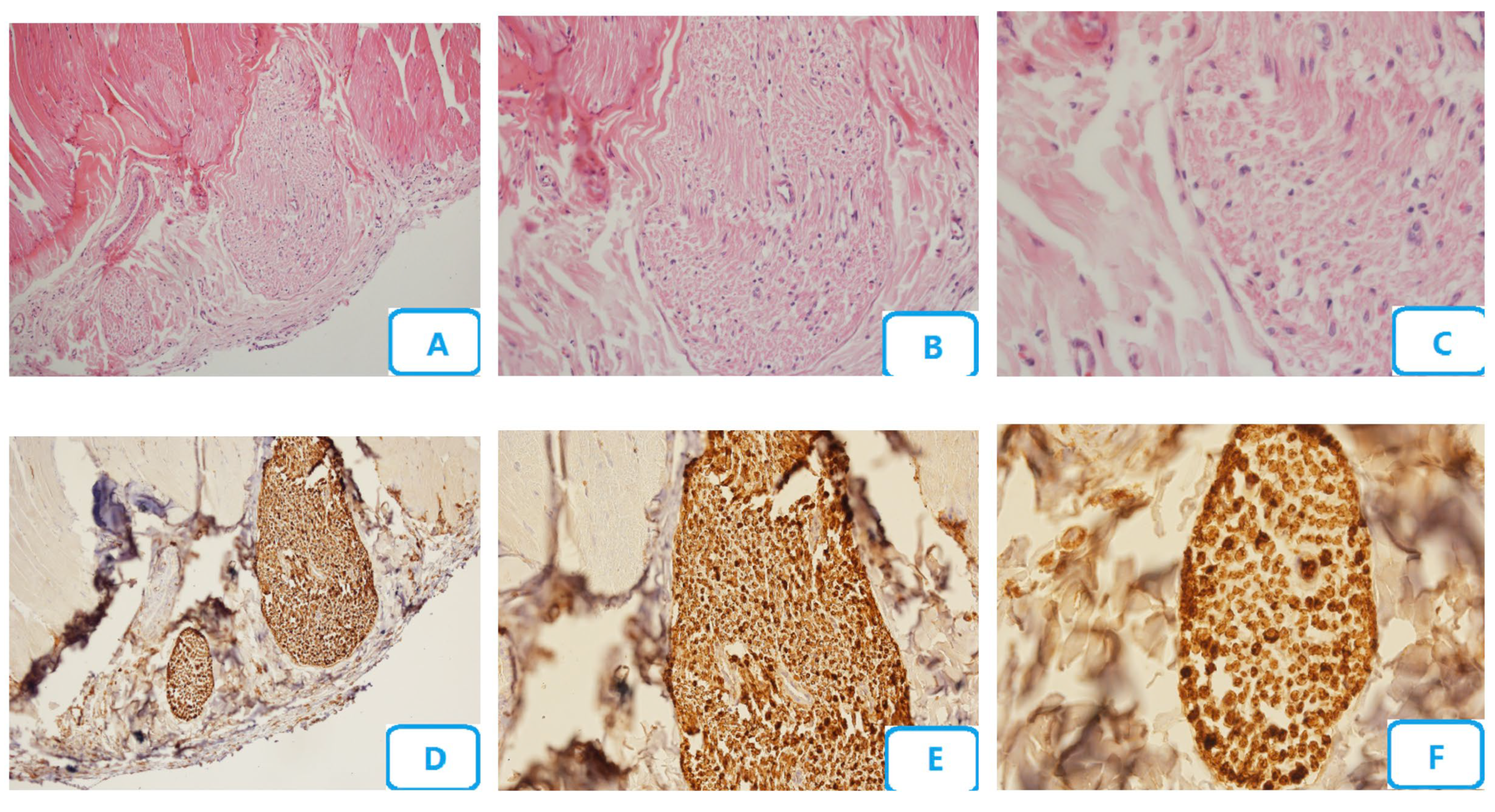 Biomedicines 13 00065 g004 Biomedicines 13 00065 g004