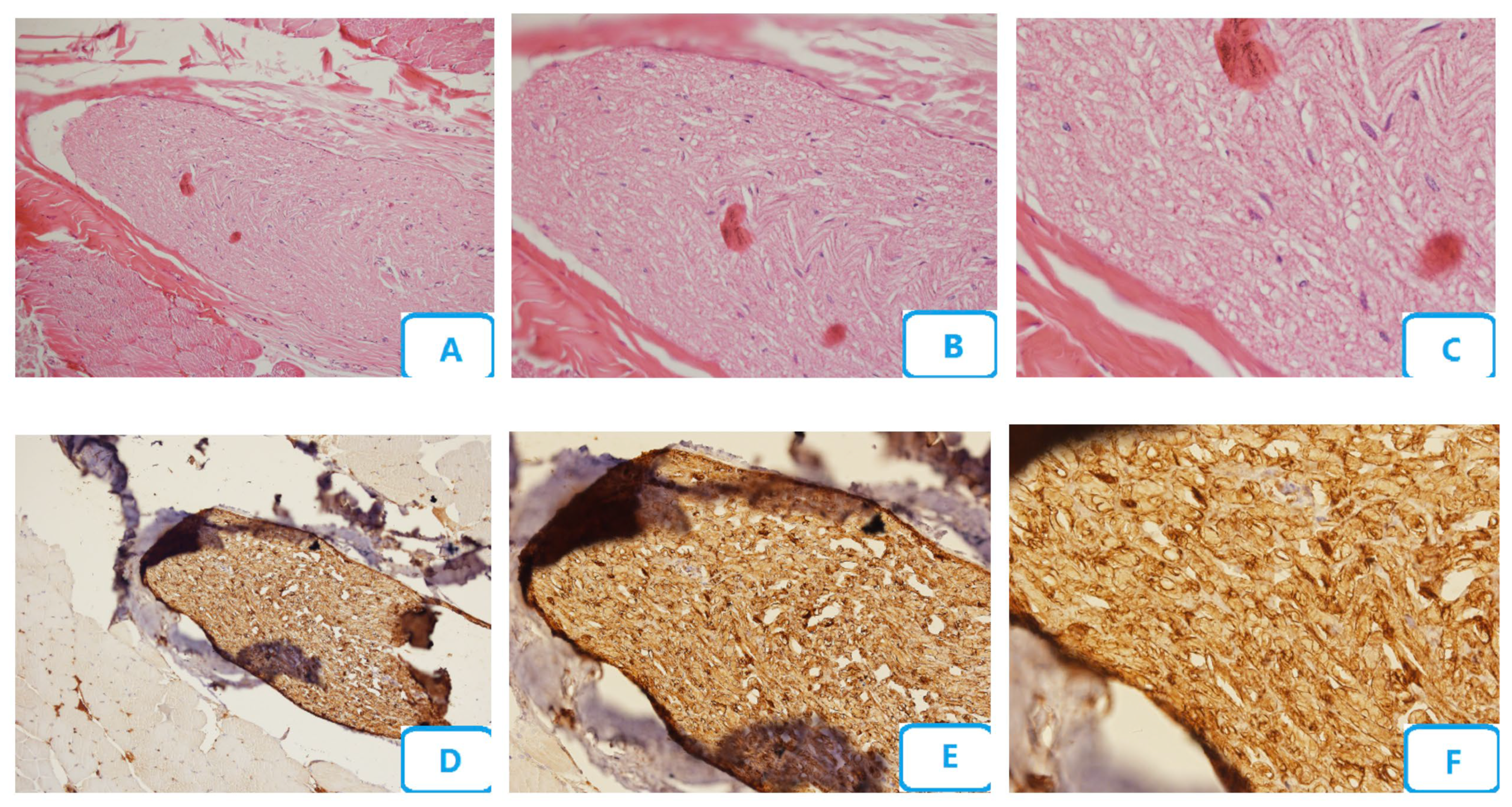 Biomedicines 13 00065 g006 Biomedicines 13 00065 g006
